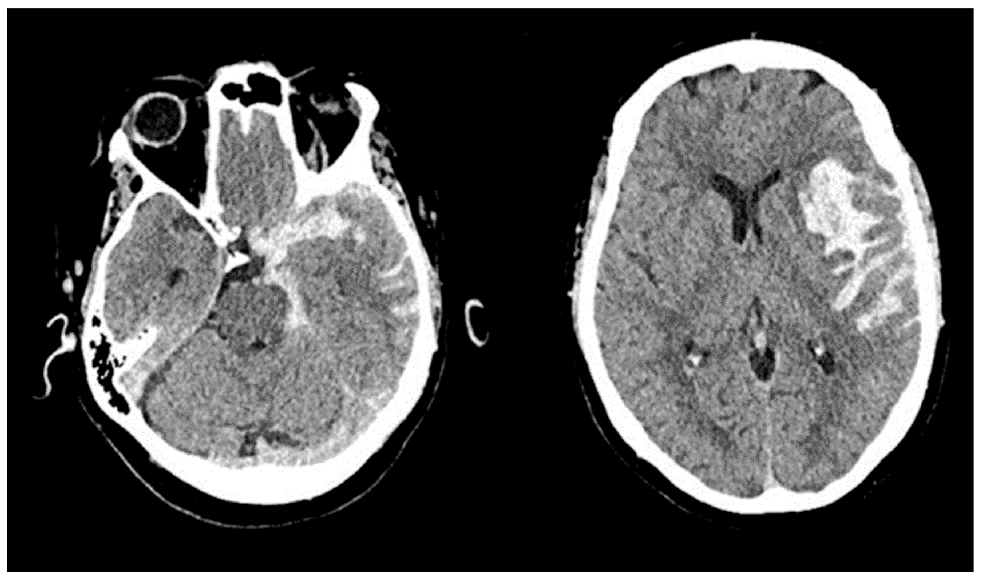 Jpm 13 00428 g005 Jpm 13 00428 g005