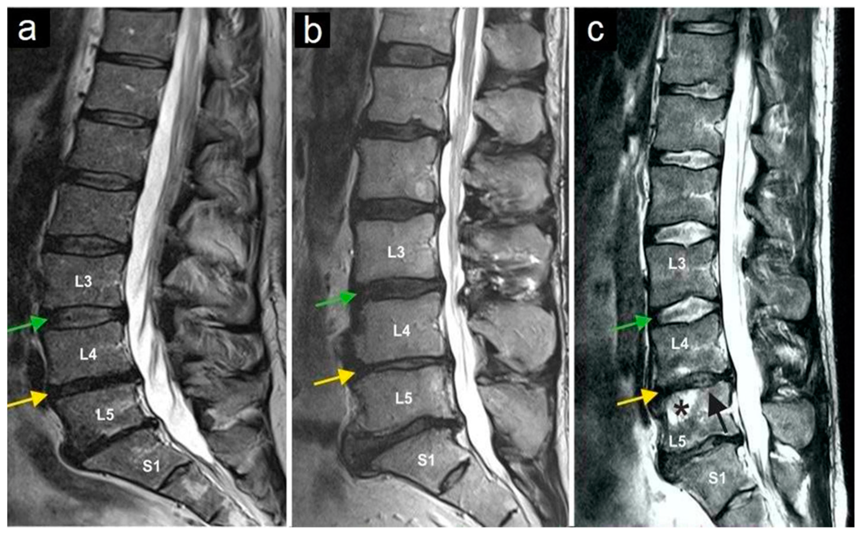 Jpm 13 00436 g003 Jpm 13 00436 g003