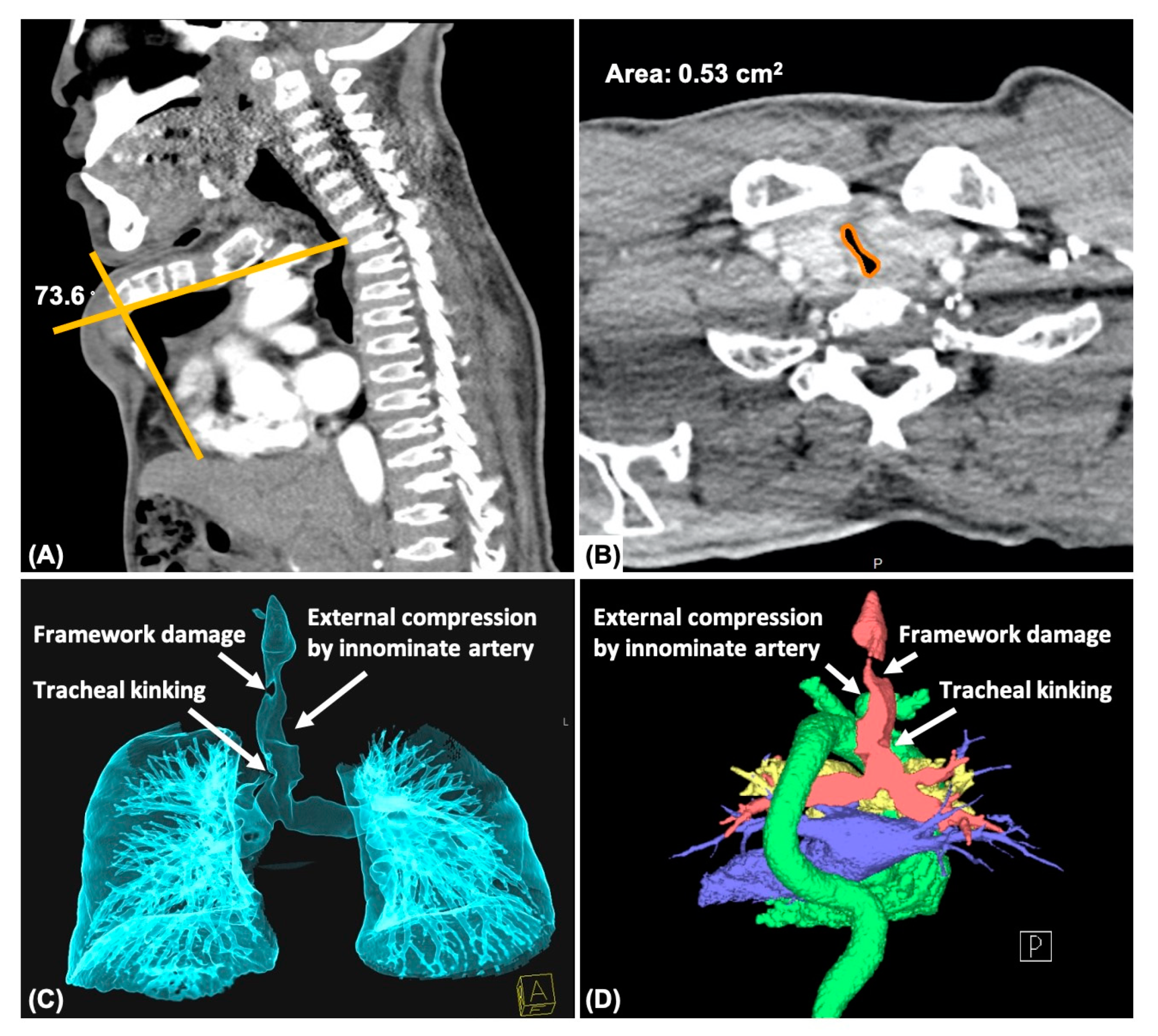 Jpm 13 00494 g002 Jpm 13 00494 g002