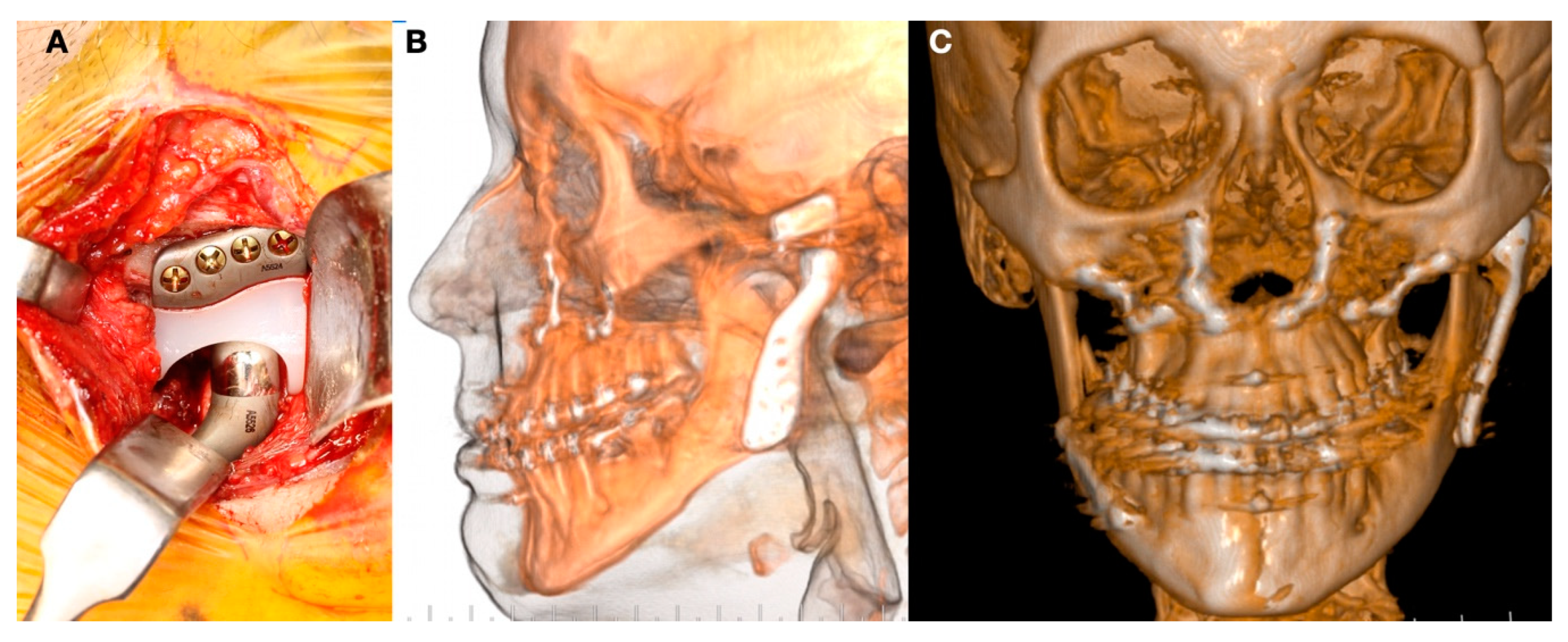 Jpm 13 00533 g003 Jpm 13 00533 g003