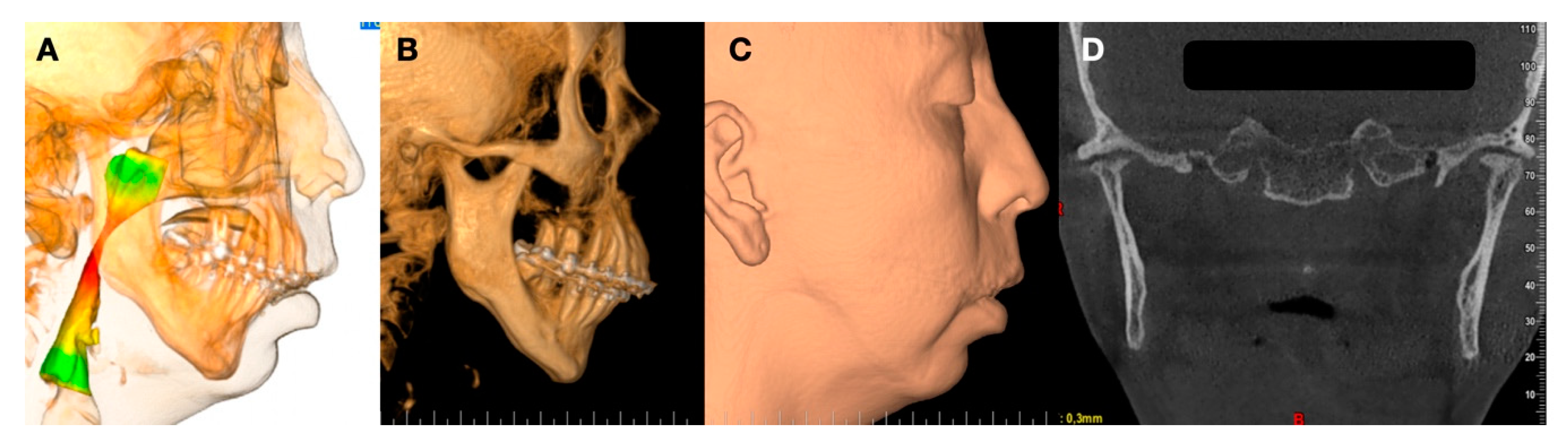 Jpm 13 00533 g004 Jpm 13 00533 g004