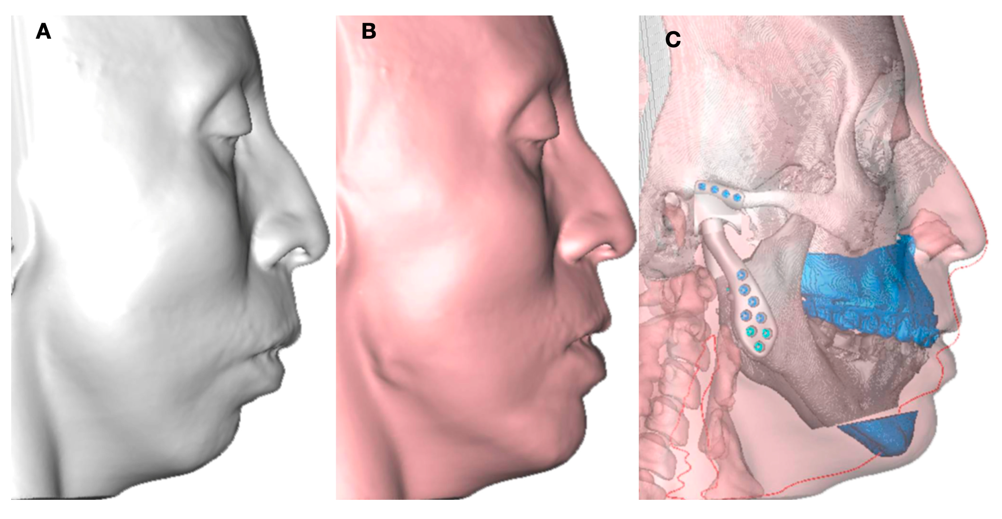 Jpm 13 00533 g005 Jpm 13 00533 g005