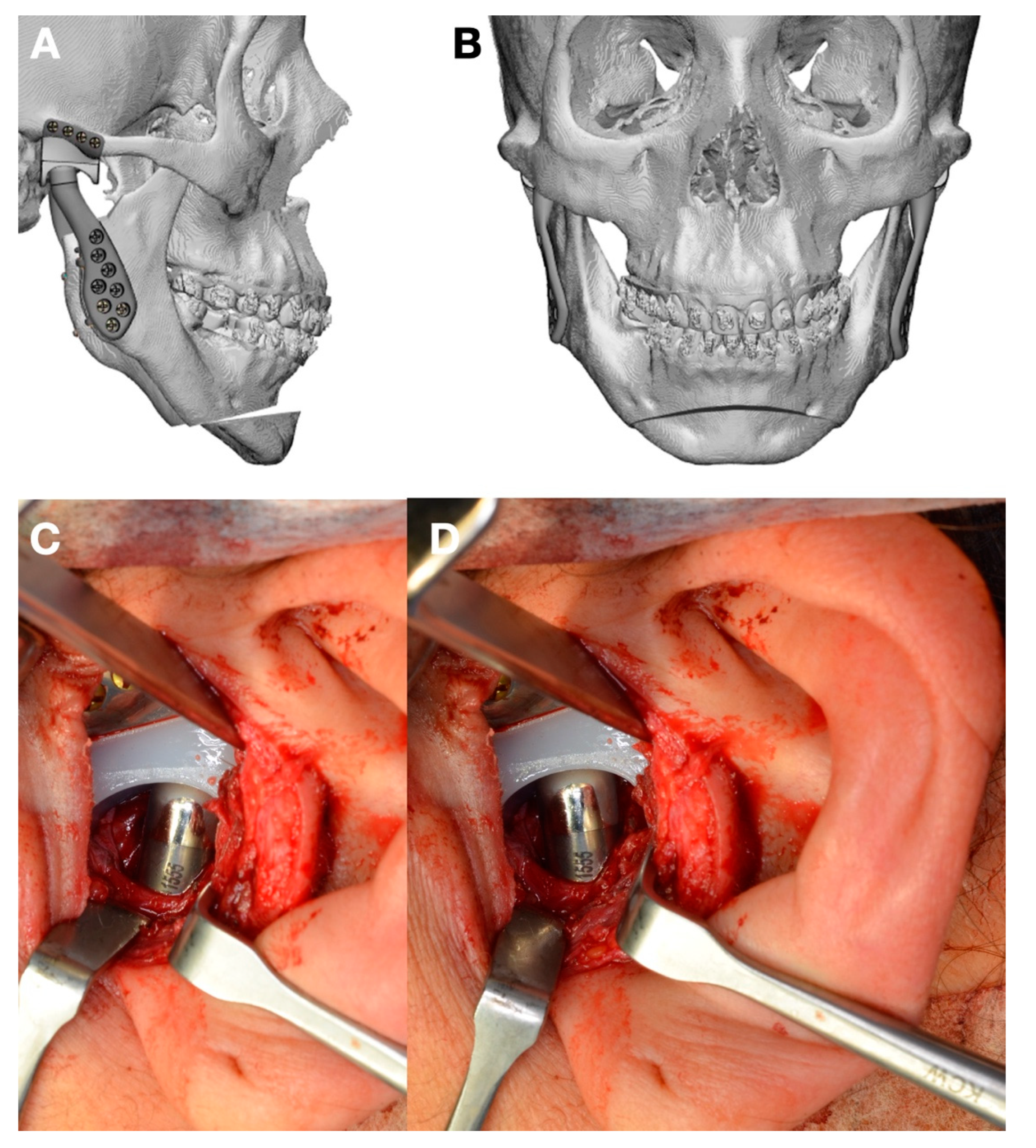Jpm 13 00533 g006 Jpm 13 00533 g006