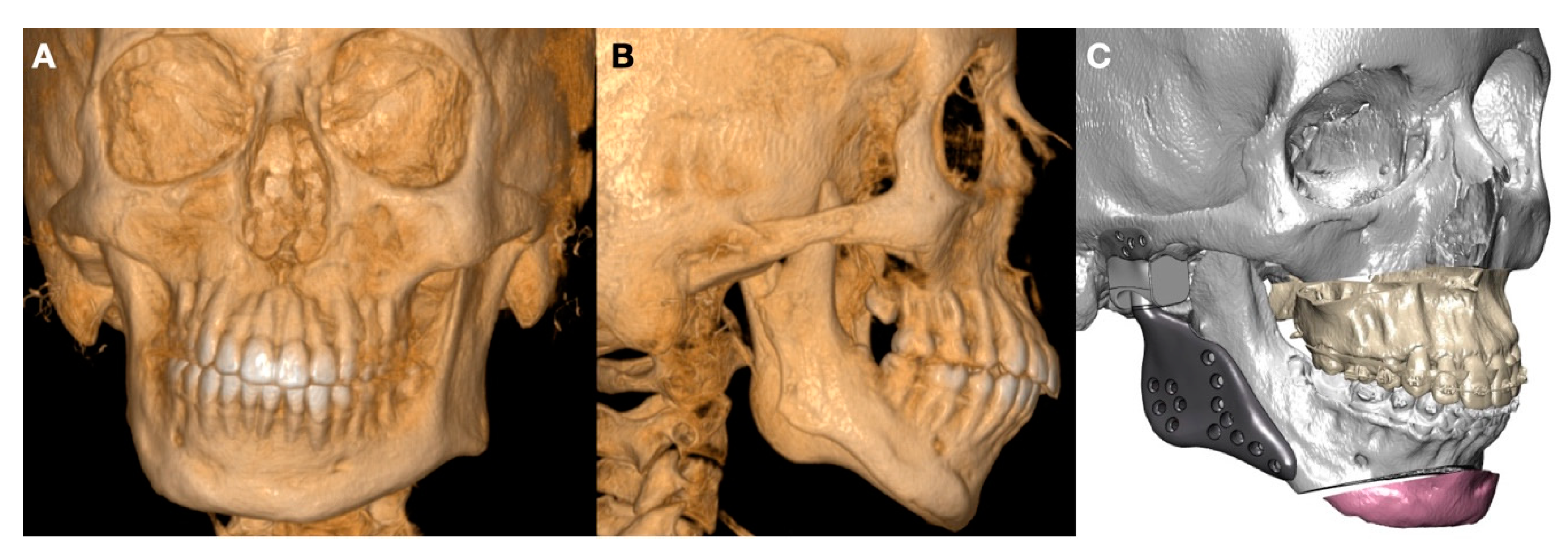 Jpm 13 00533 g008 Jpm 13 00533 g008