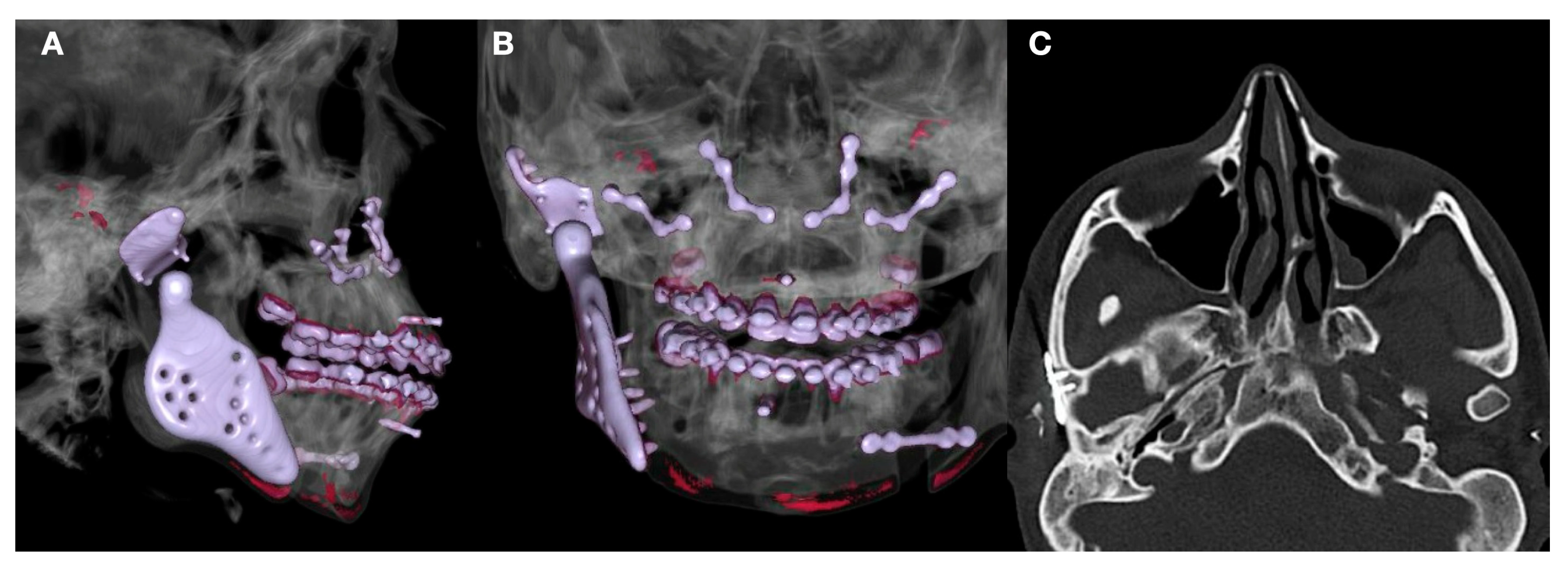 Jpm 13 00533 g009 Jpm 13 00533 g009