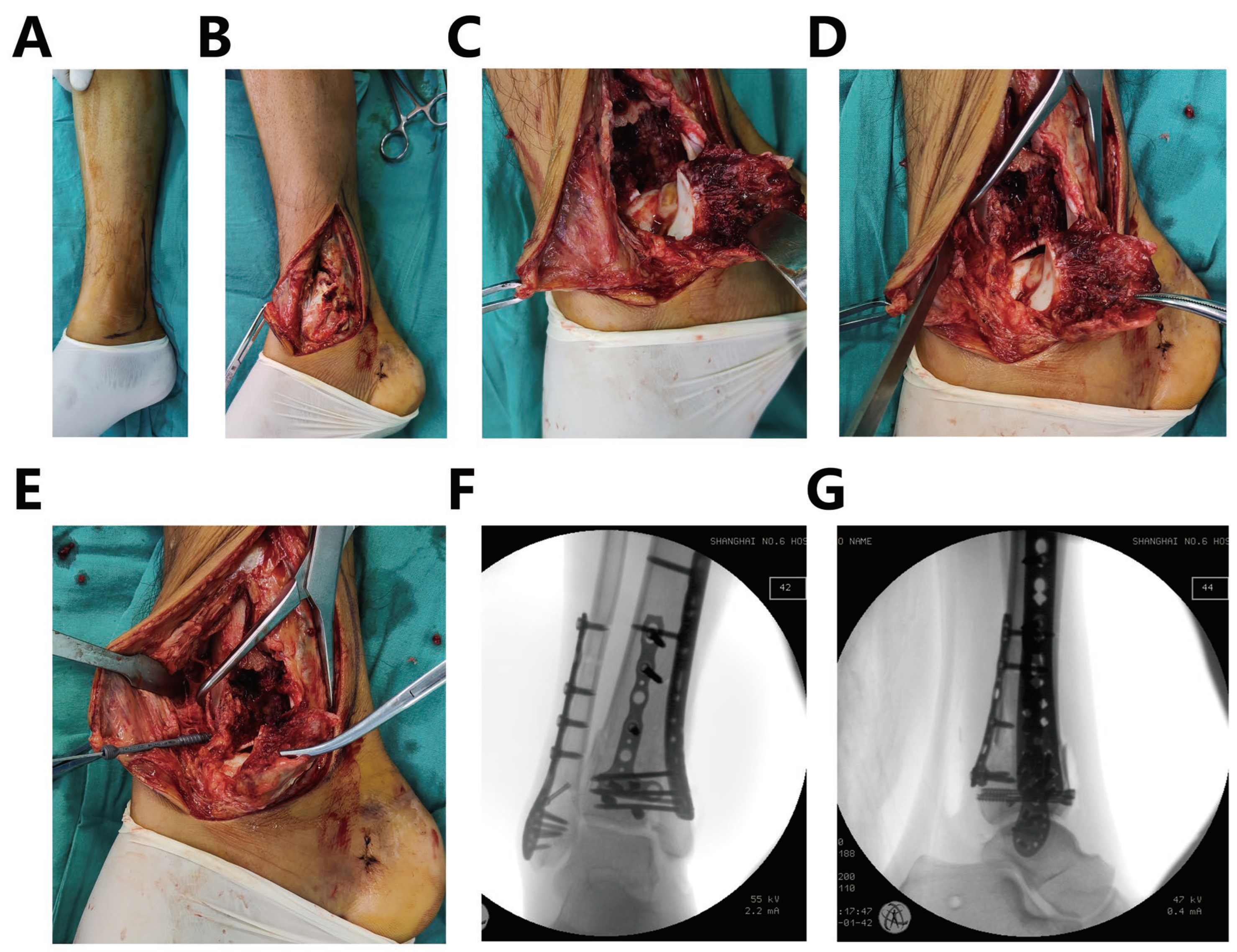 Jpm 13 00551 g002 Jpm 13 00551 g002