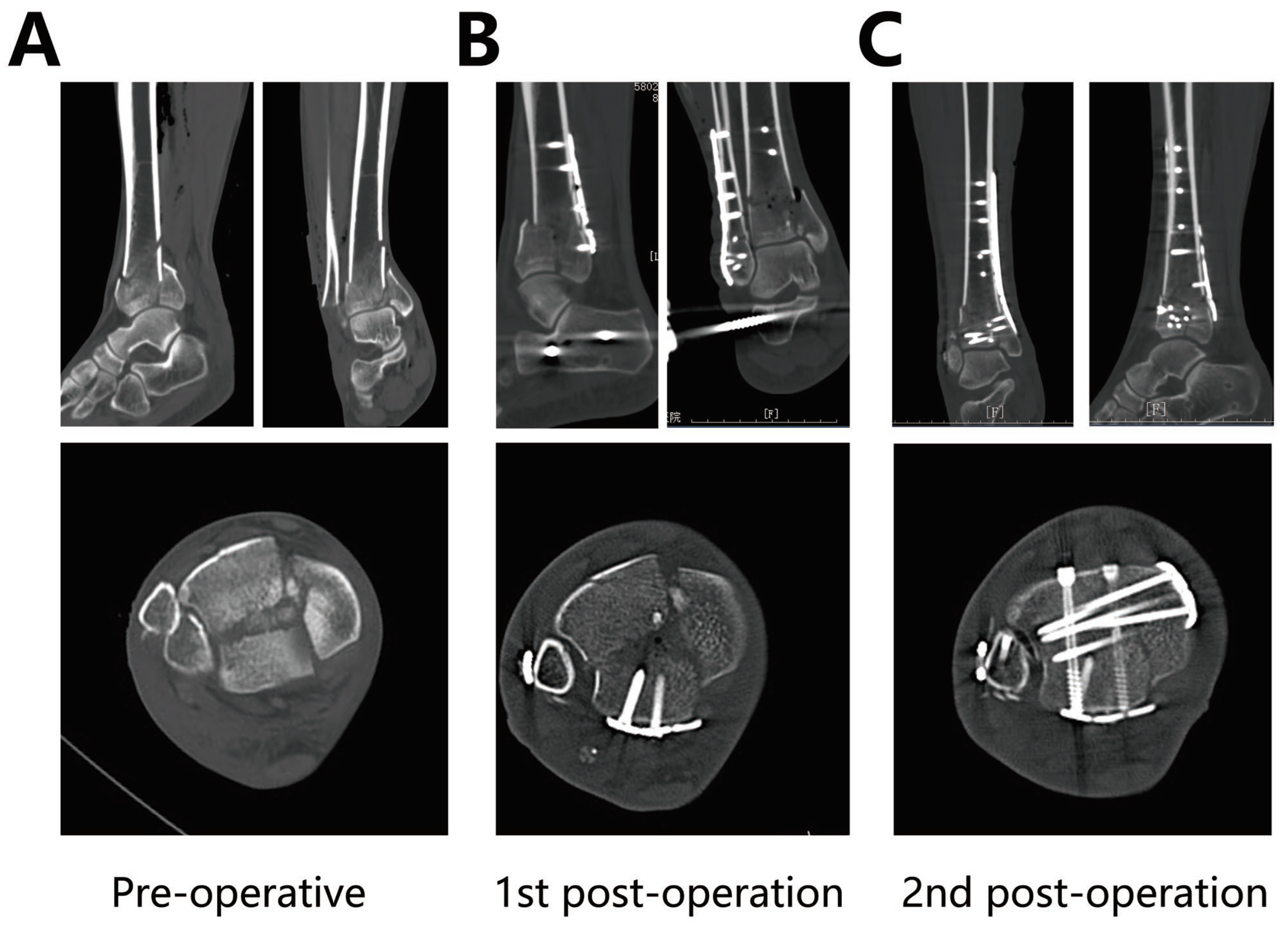 Jpm 13 00551 g004 Jpm 13 00551 g004