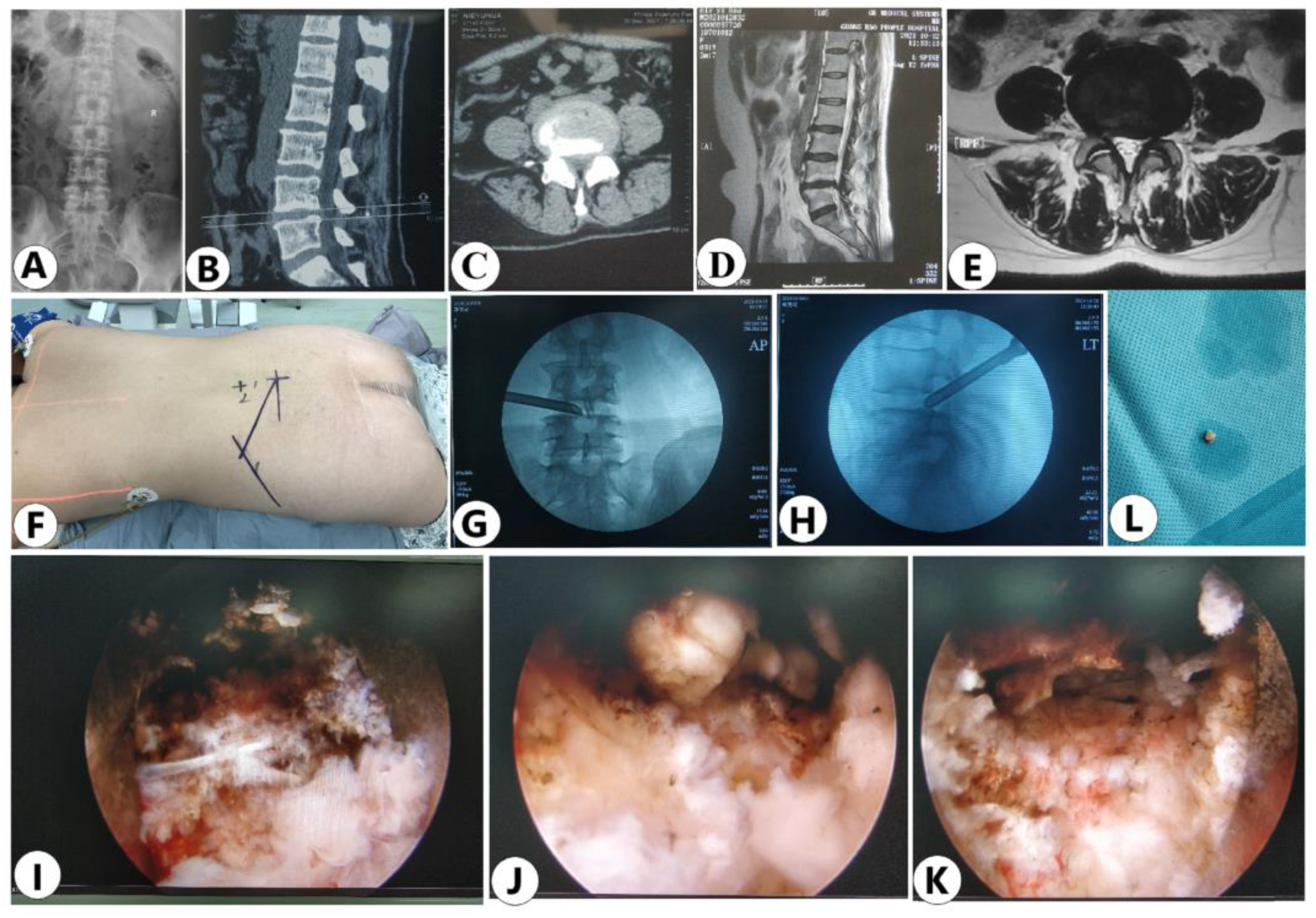 Jpm 13 00552 g007 Jpm 13 00552 g007
