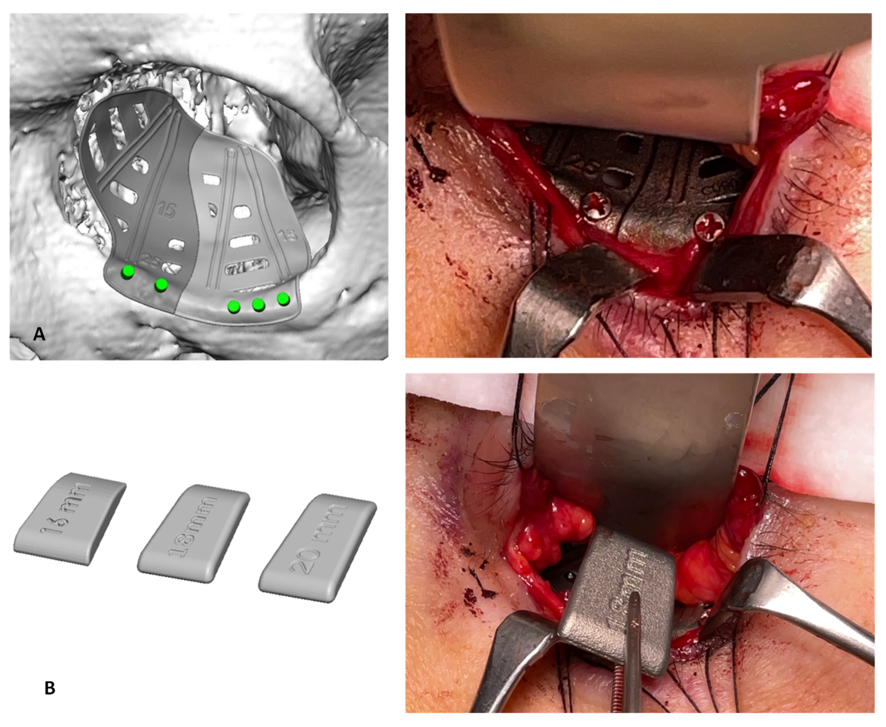 Jpm 13 00578 g003 Jpm 13 00578 g003