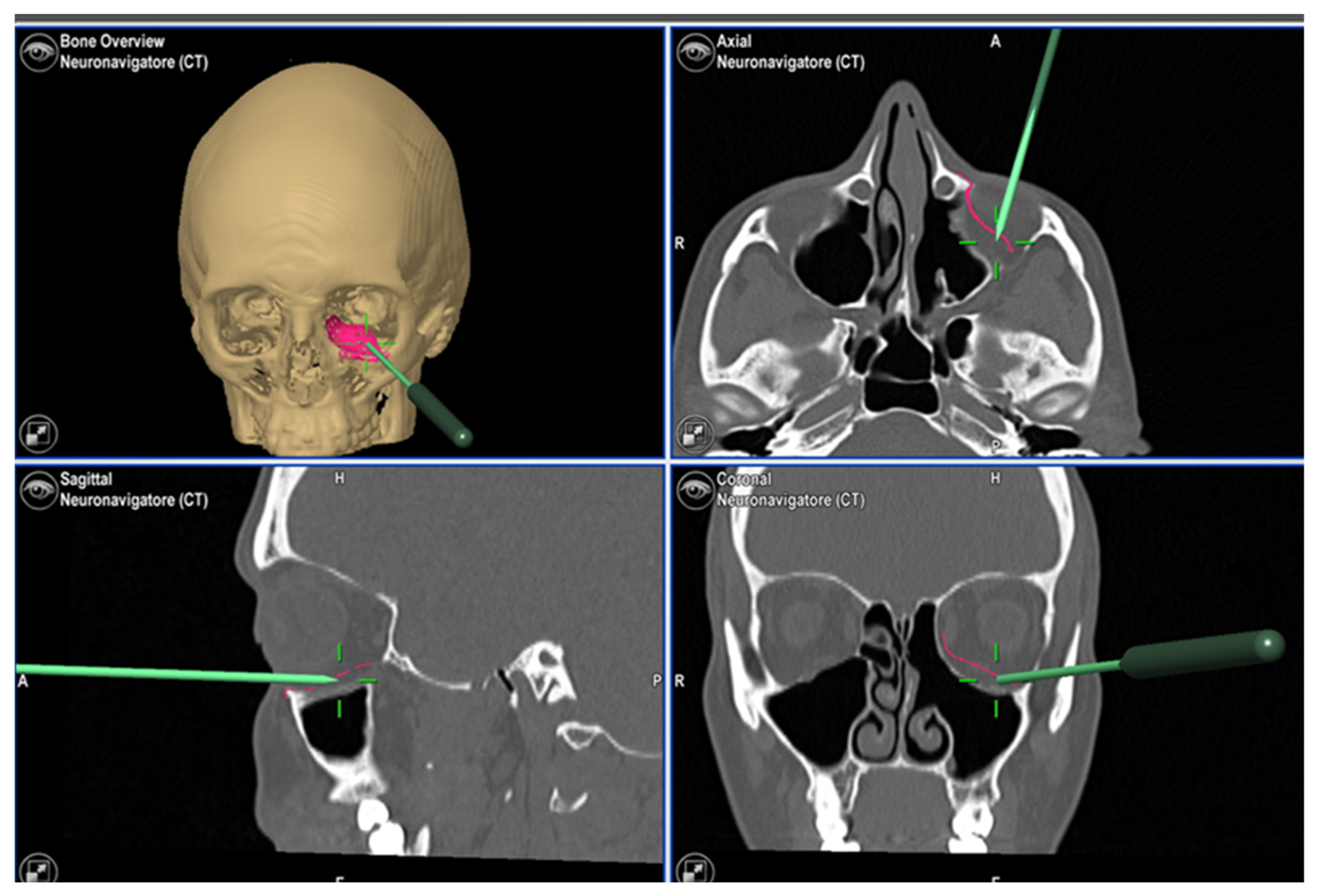 Jpm 13 00578 g005 Jpm 13 00578 g005