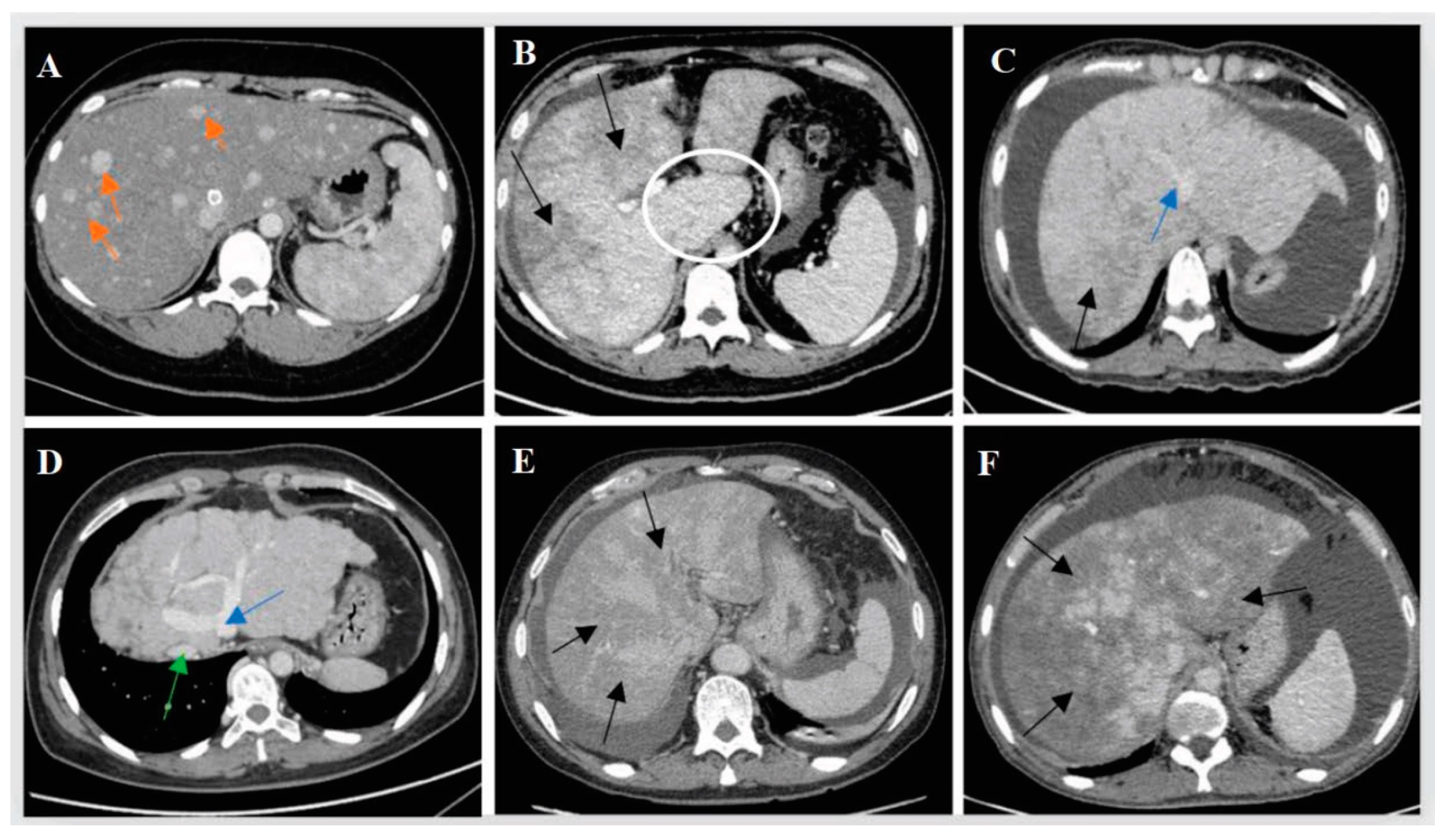 Jpm 13 00603 g002 Jpm 13 00603 g002