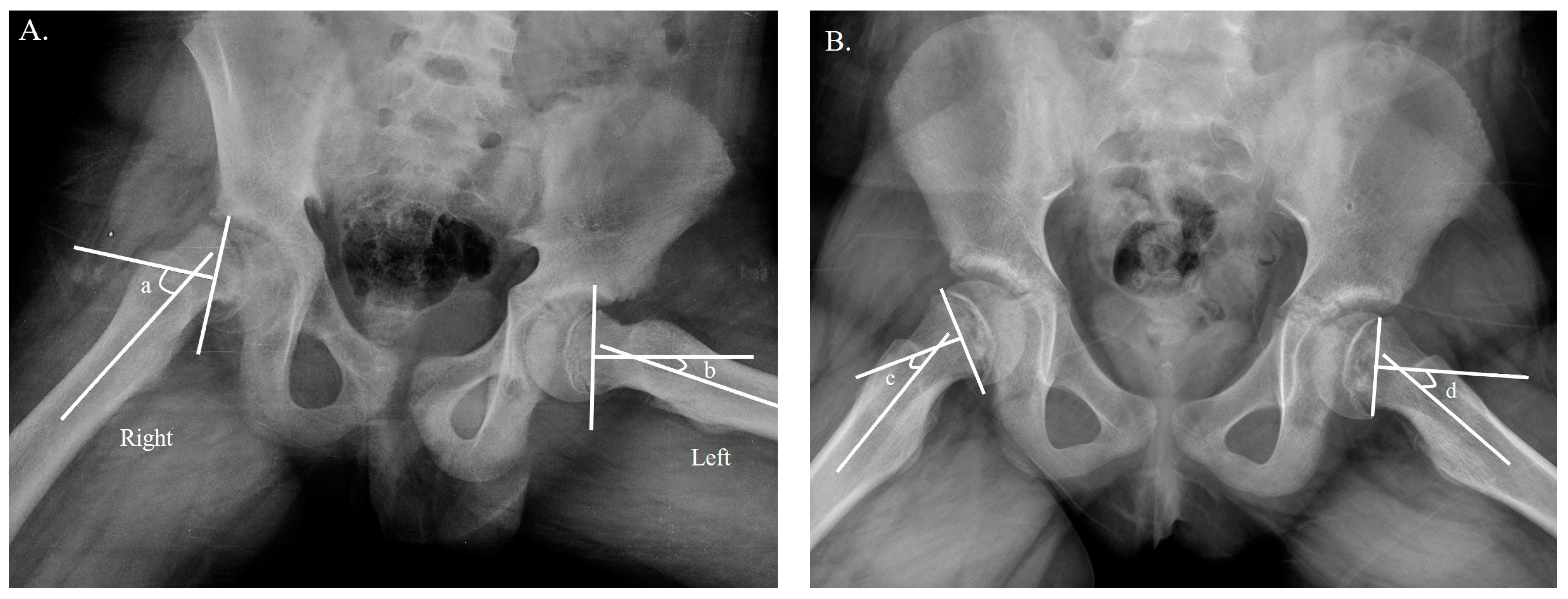Jpm 13 00604 g001 Jpm 13 00604 g001