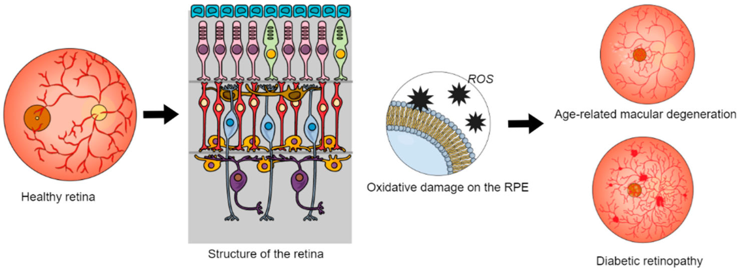 Inborn errors of metabolism leading to neuronal migration defects -  Schiller - 2020 - Journal of Inherited Metabolic Disease - Wiley Online  Library