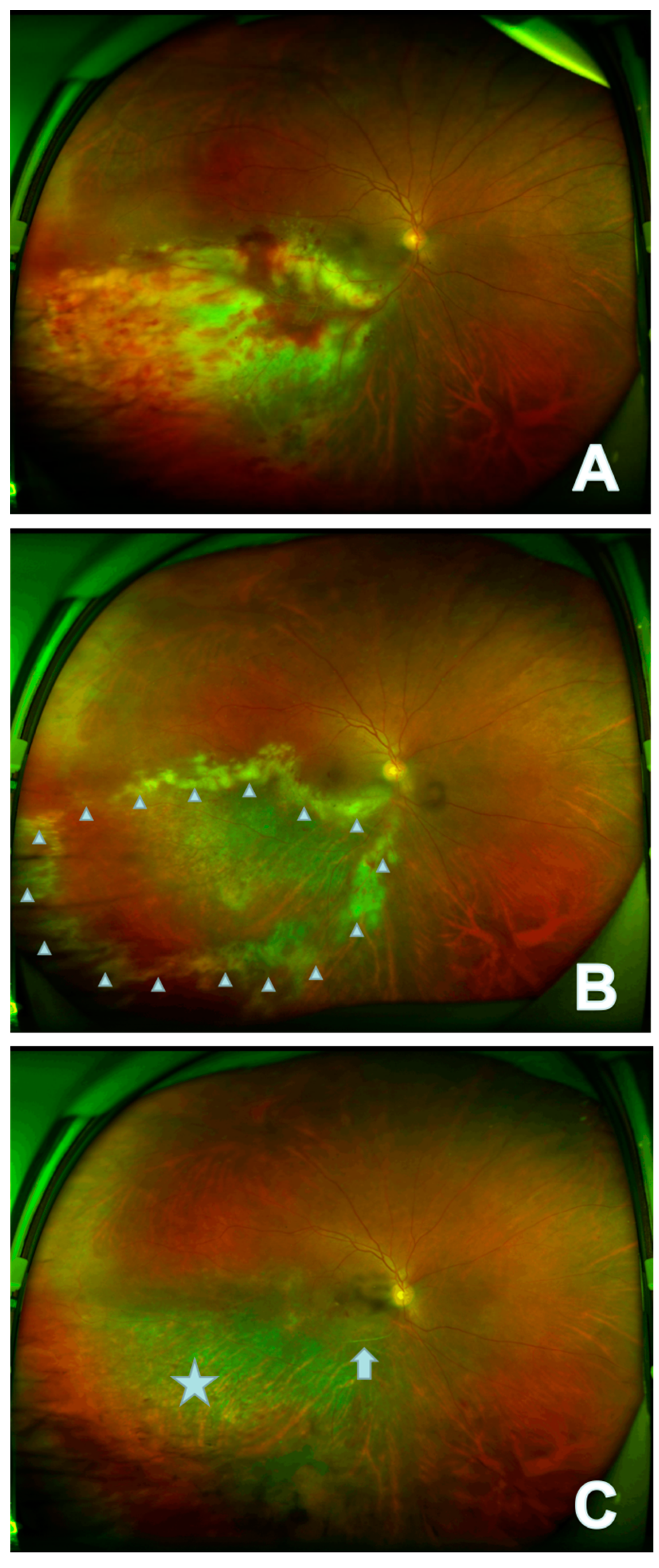 Jpm 13 00639 g001 Jpm 13 00639 g001