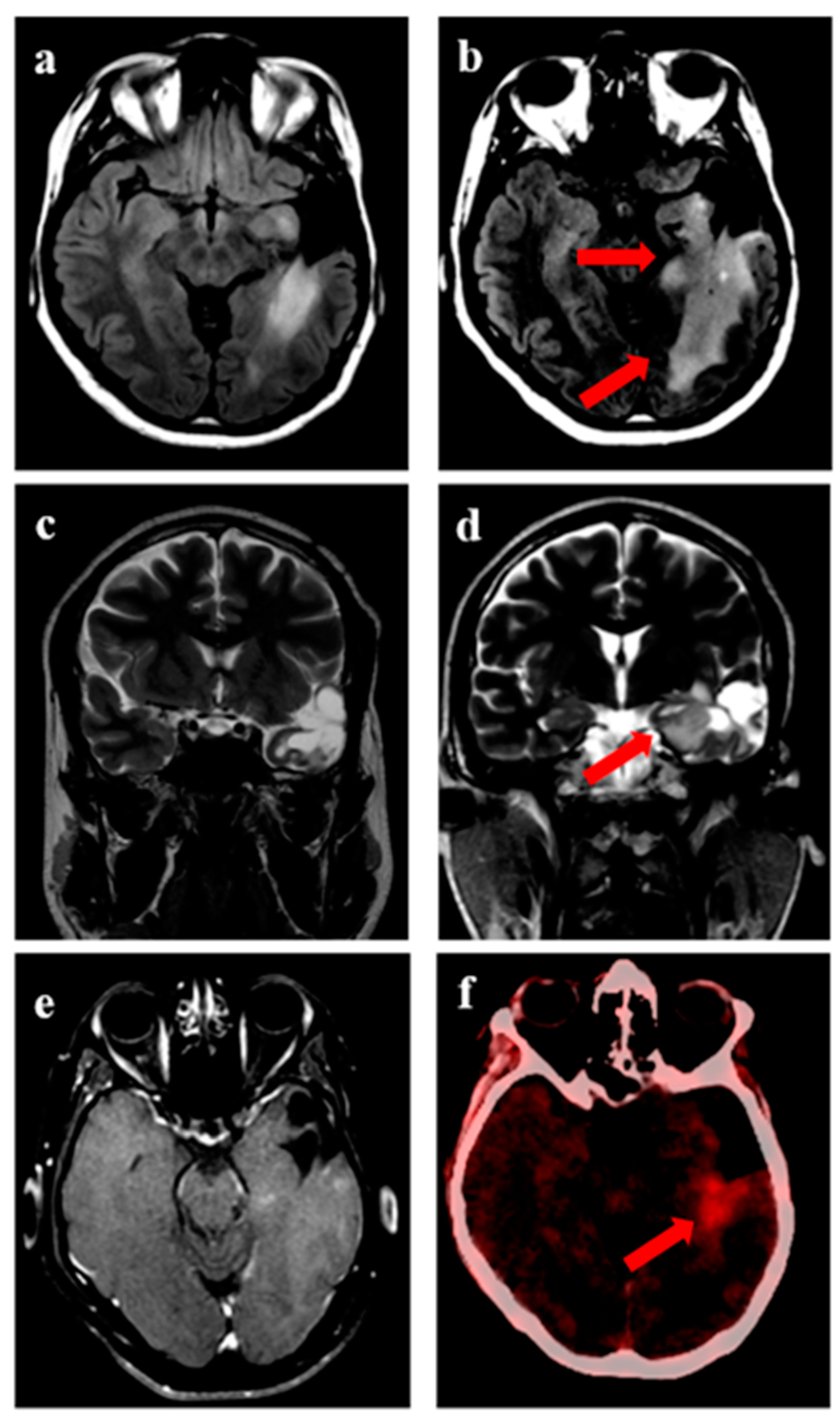Jpm 13 00685 g002 Jpm 13 00685 g002