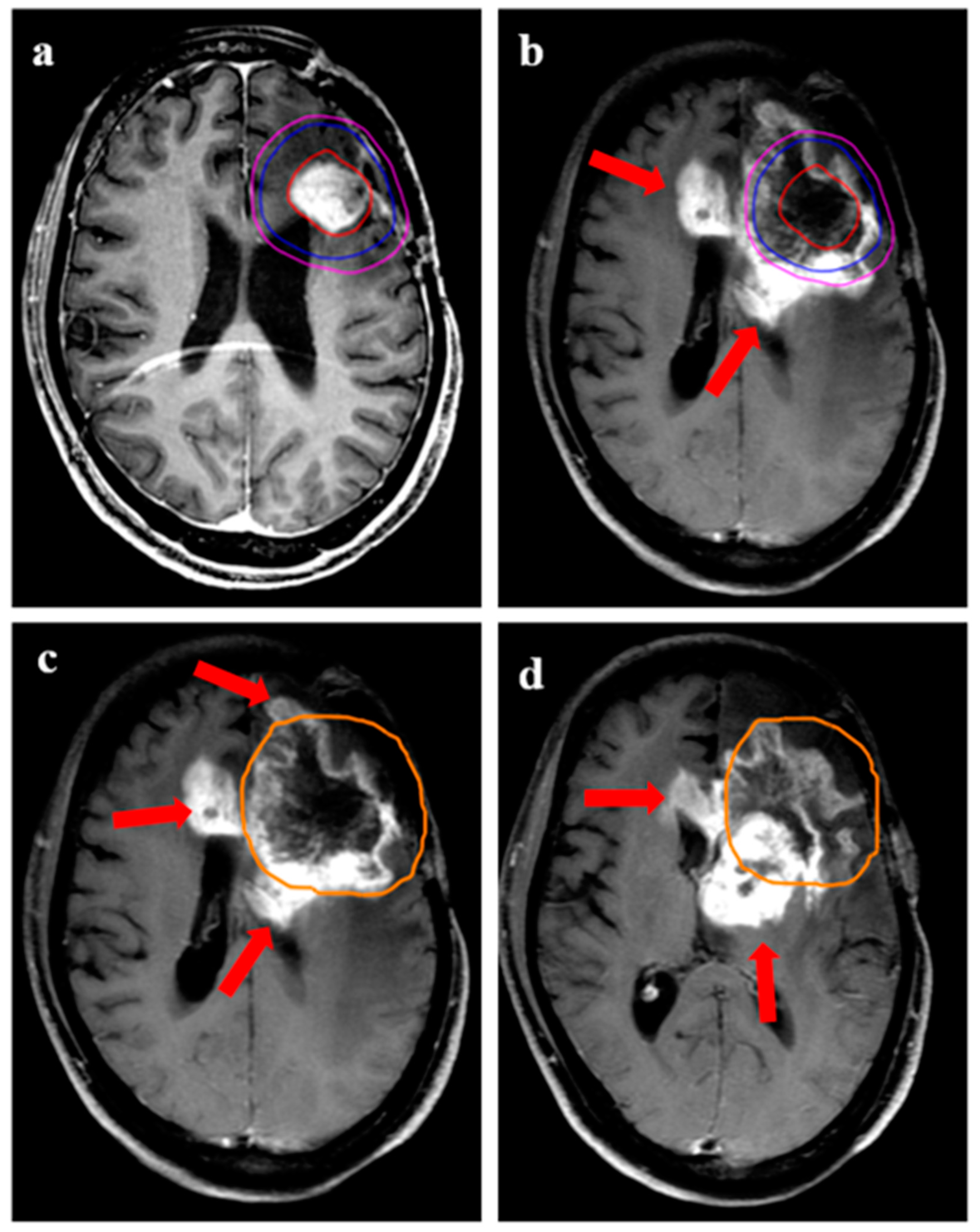 Jpm 13 00685 g006 Jpm 13 00685 g006