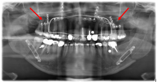 すべての歯科医師のための臨床解剖学に基づいたComprehensive Dental Surgery すべての歯科医師のための 臨床解剖学に基づいたComprehensive