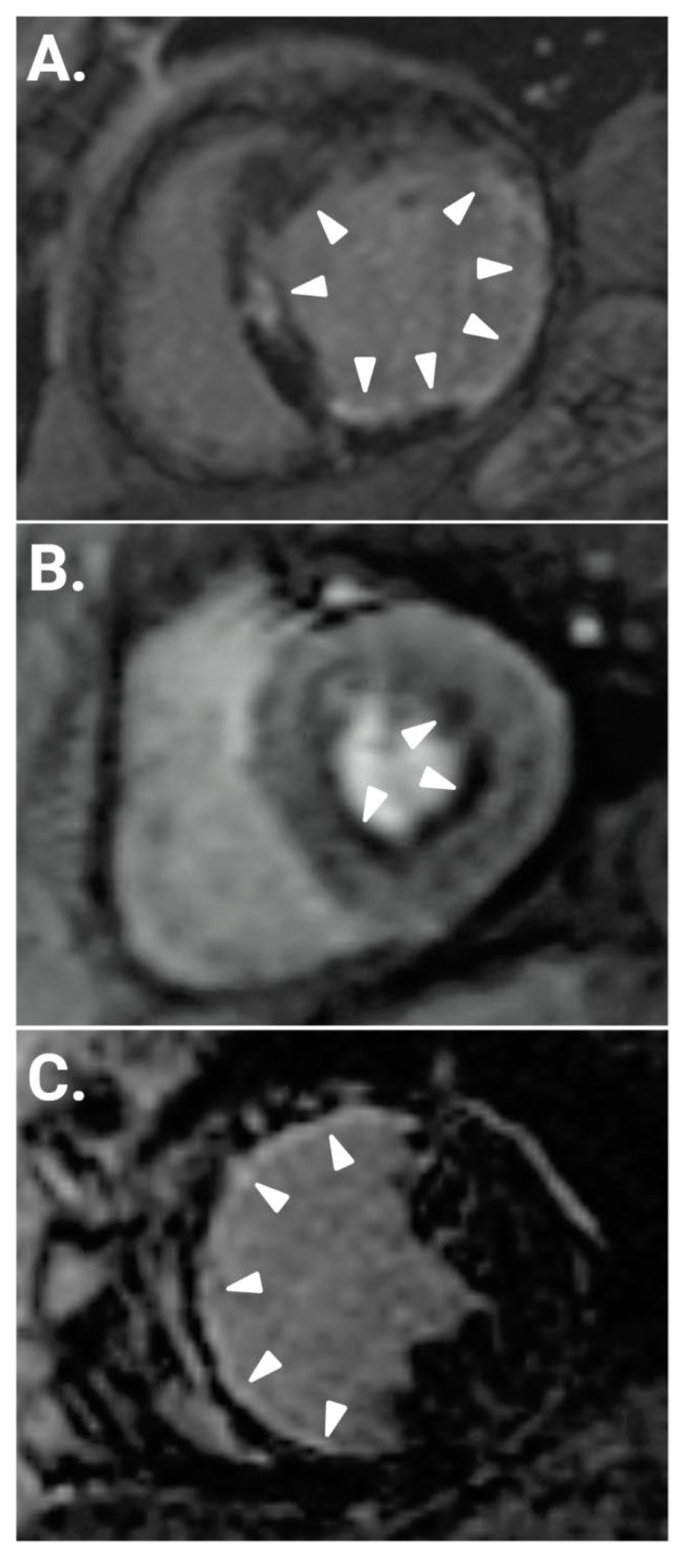 Jpm 13 00724 g001 Jpm 13 00724 g001
