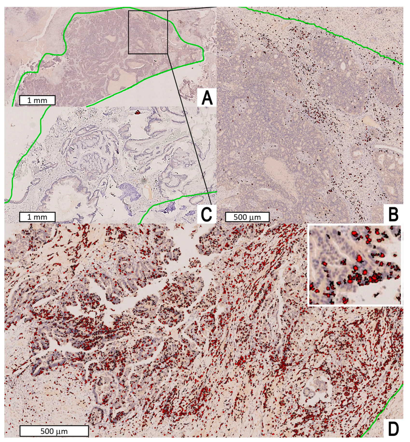 Jpm 13 00726 g003 Jpm 13 00726 g003