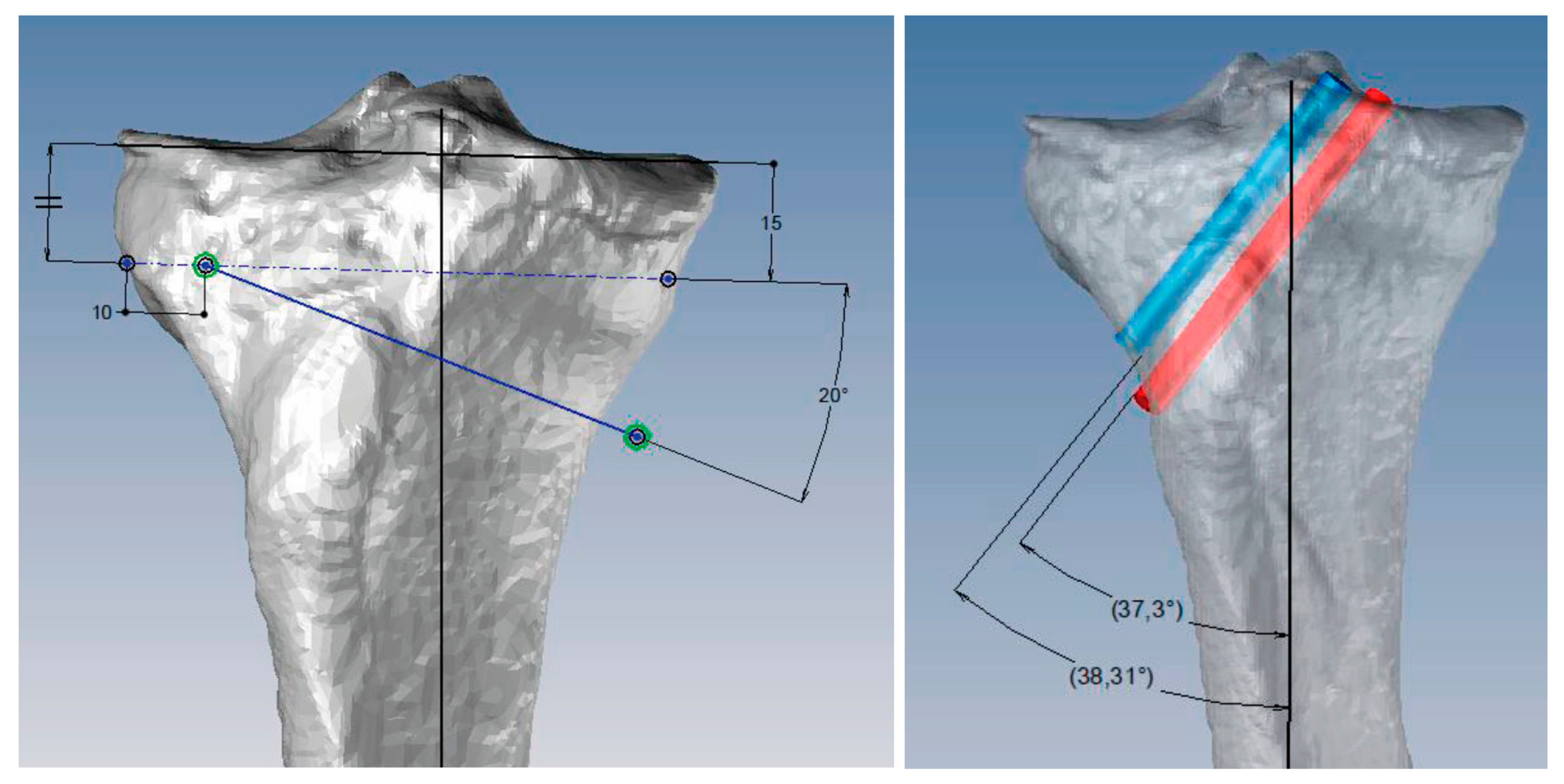 Jpm 13 00727 g001 Jpm 13 00727 g001