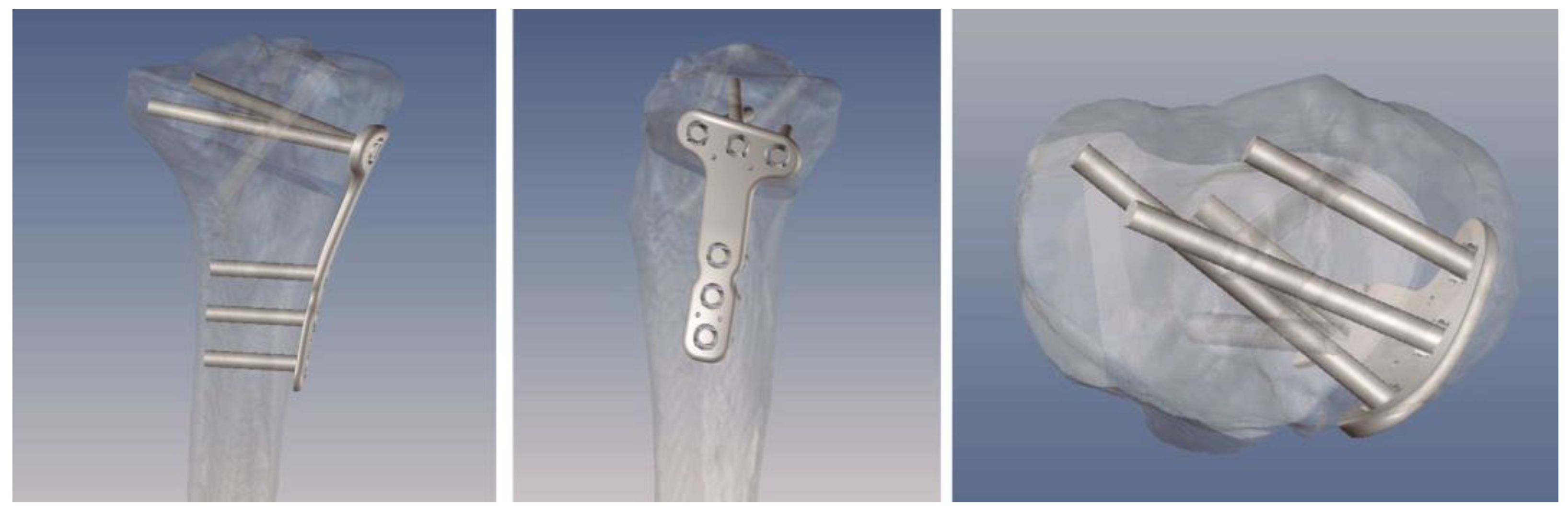 Jpm 13 00727 g003 Jpm 13 00727 g003