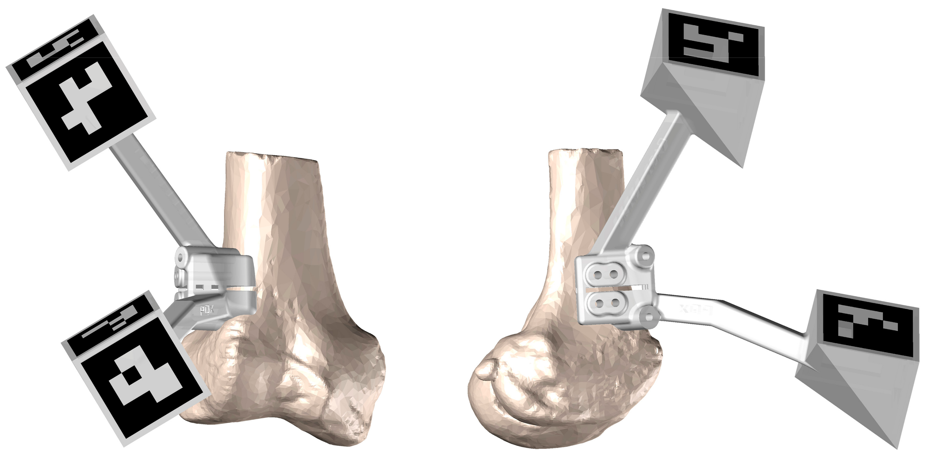 Jpm 13 00727 g005 Jpm 13 00727 g005