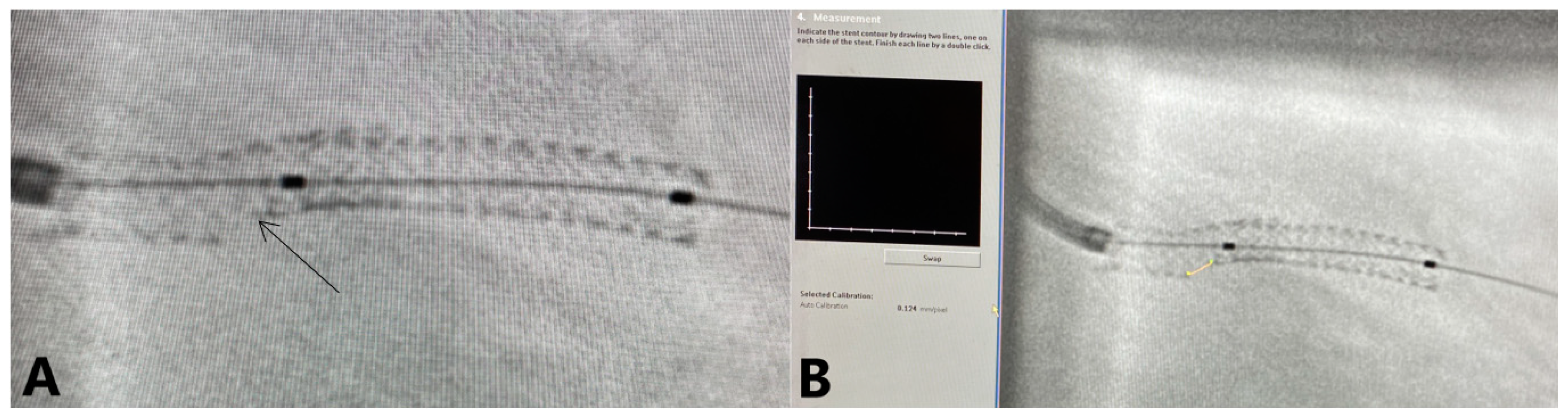 Jpm 13 00791 g002 Jpm 13 00791 g002