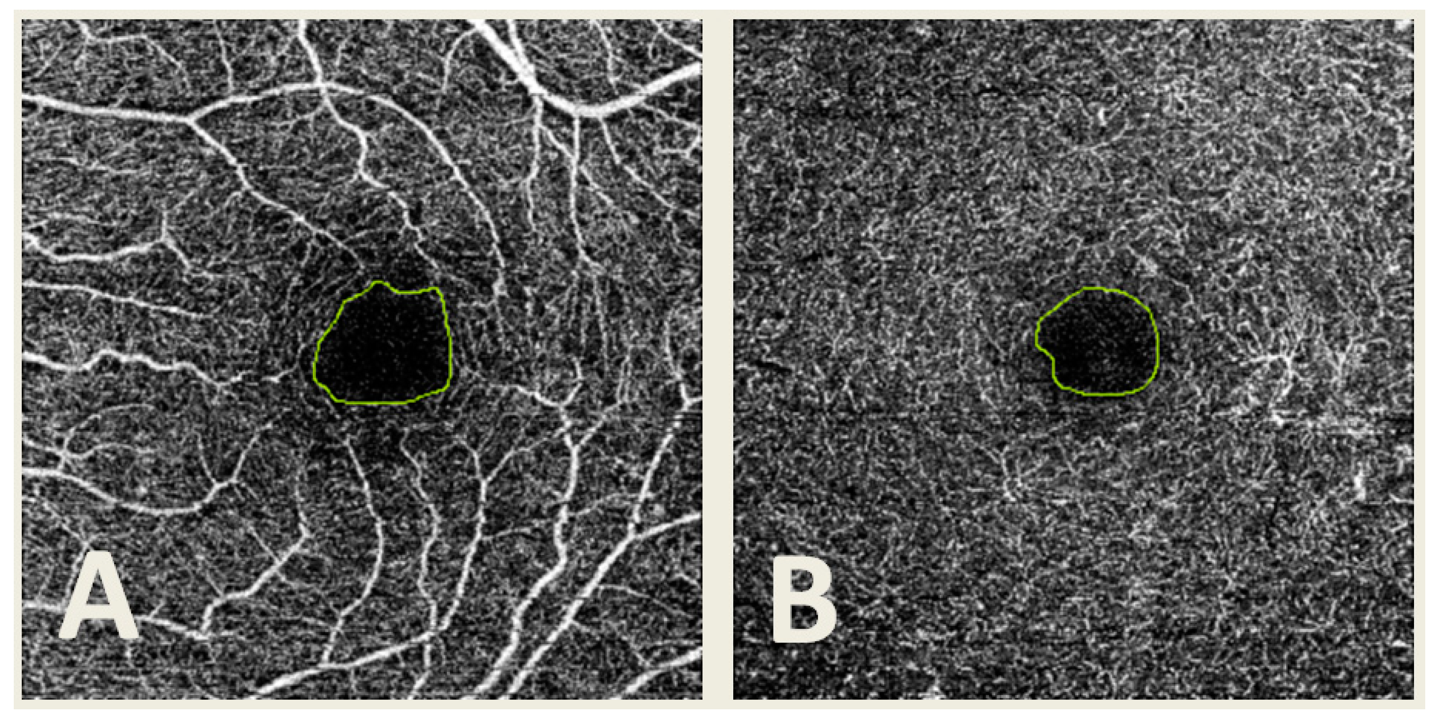 Jpm 13 00822 g002 Jpm 13 00822 g002