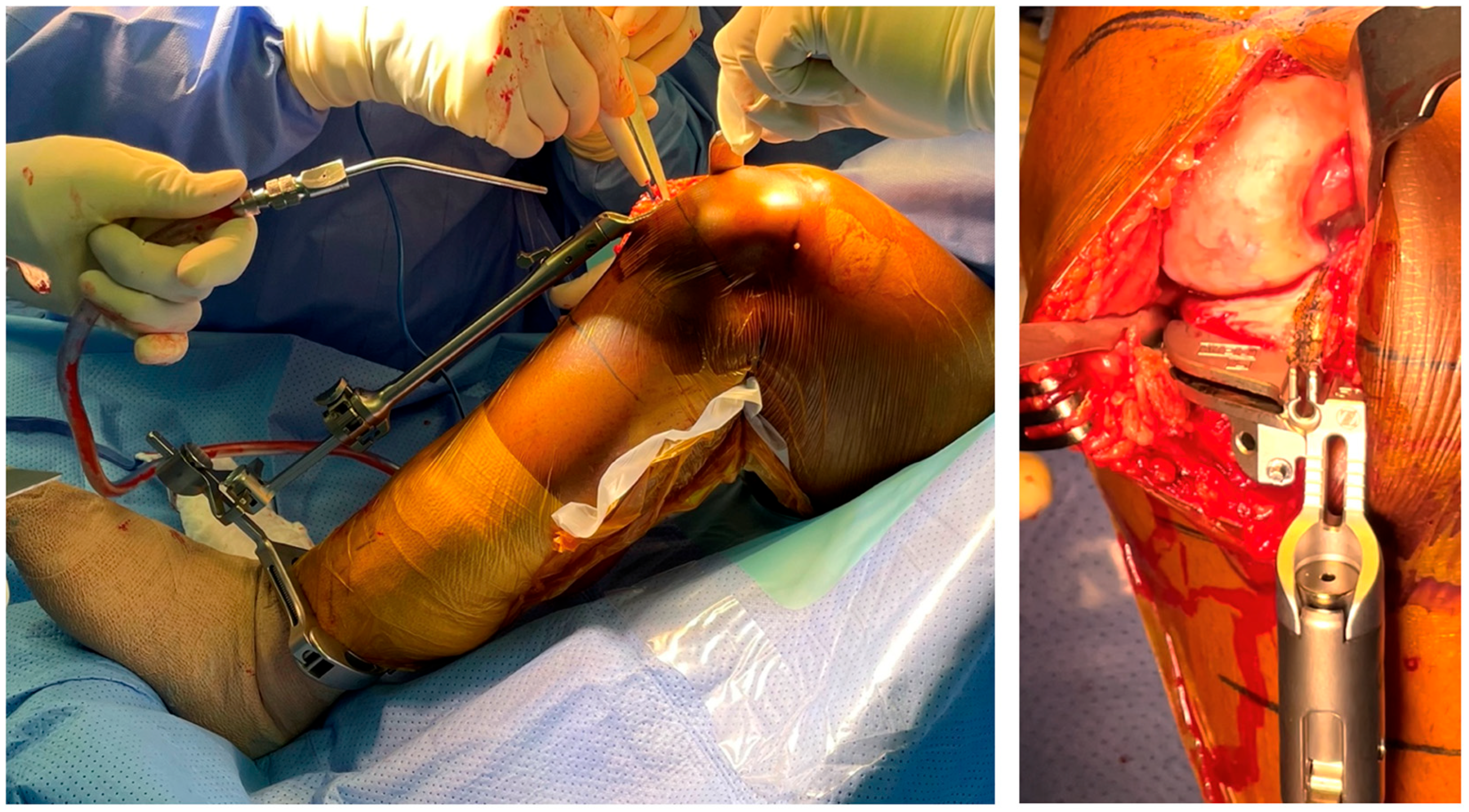 Jpm 13 00855 g001 Jpm 13 00855 g001