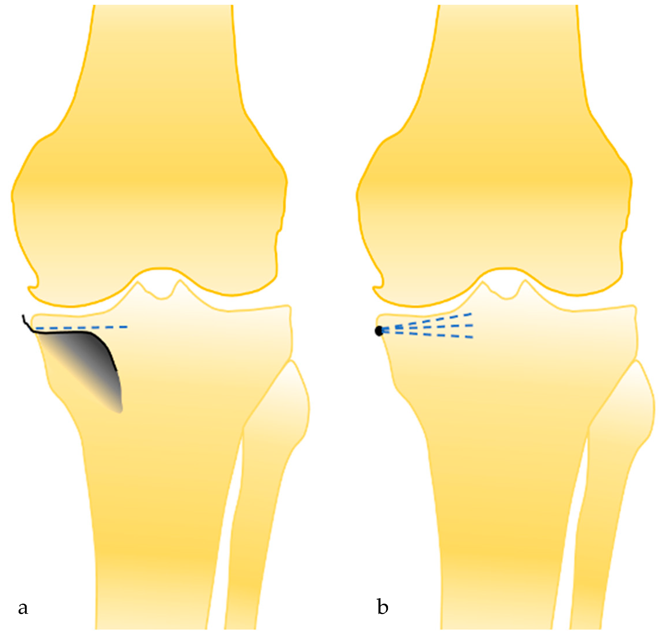 Jpm 13 00855 g003 Jpm 13 00855 g003