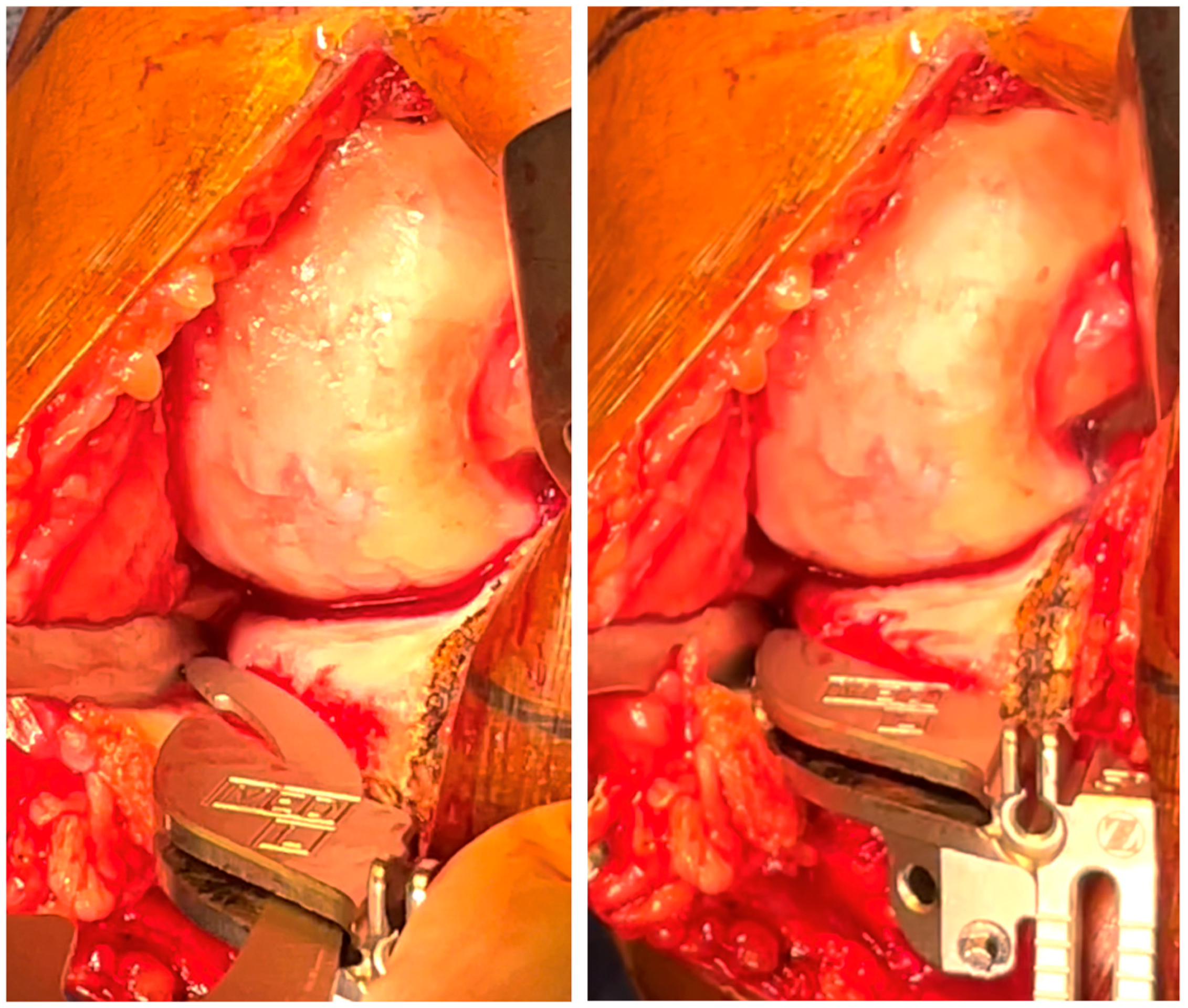 Jpm 13 00855 g004 Jpm 13 00855 g004