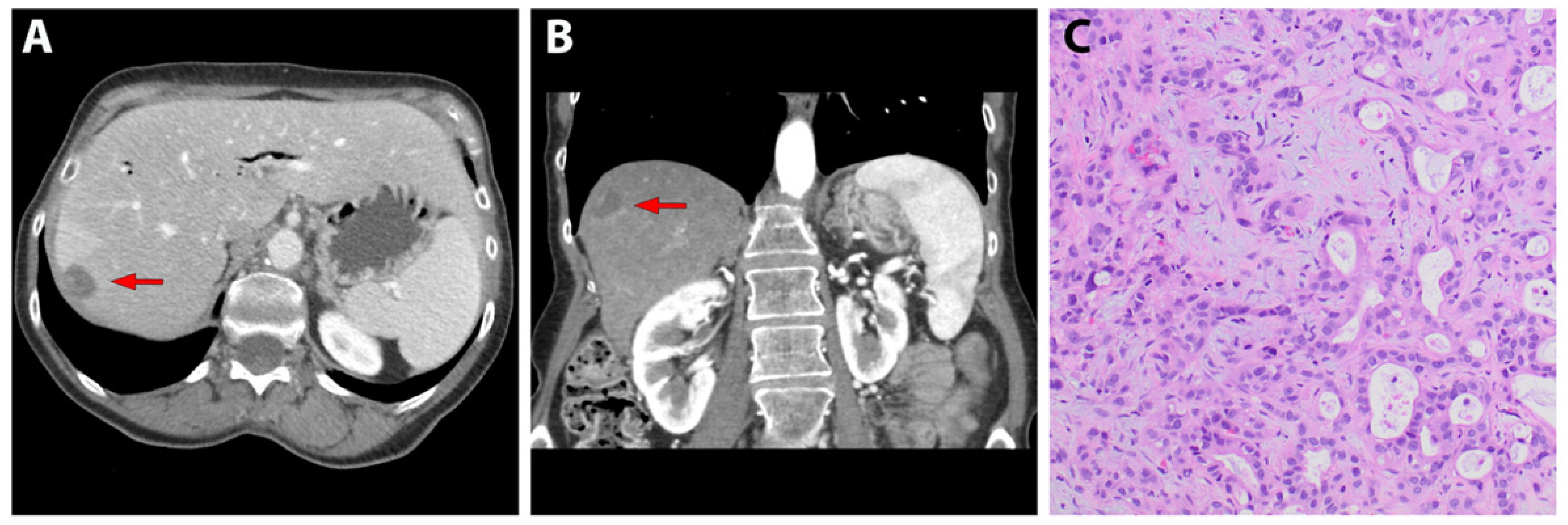 JPM Free FullText Highly Selective Targeting of Pancreatic Cancer