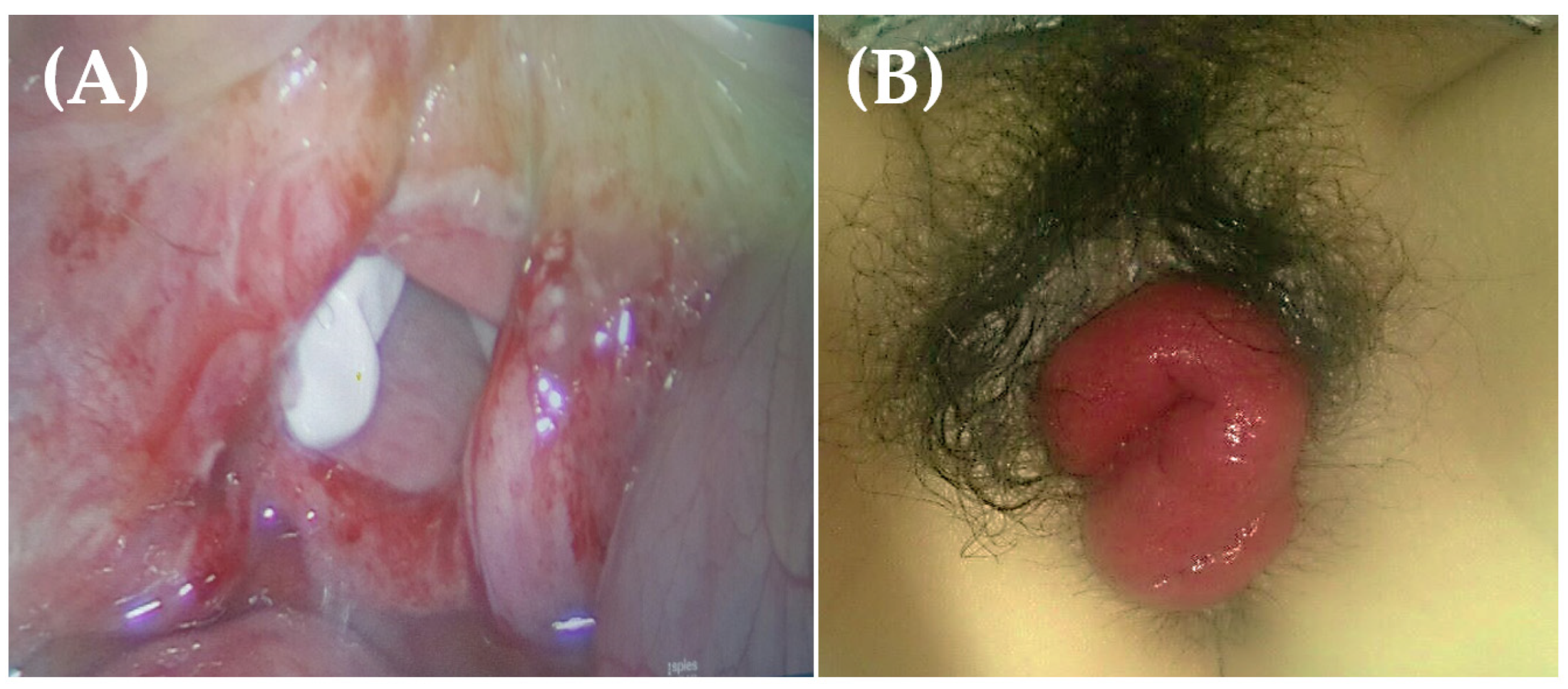 Jpm 13 00890 g001 Jpm 13 00890 g001