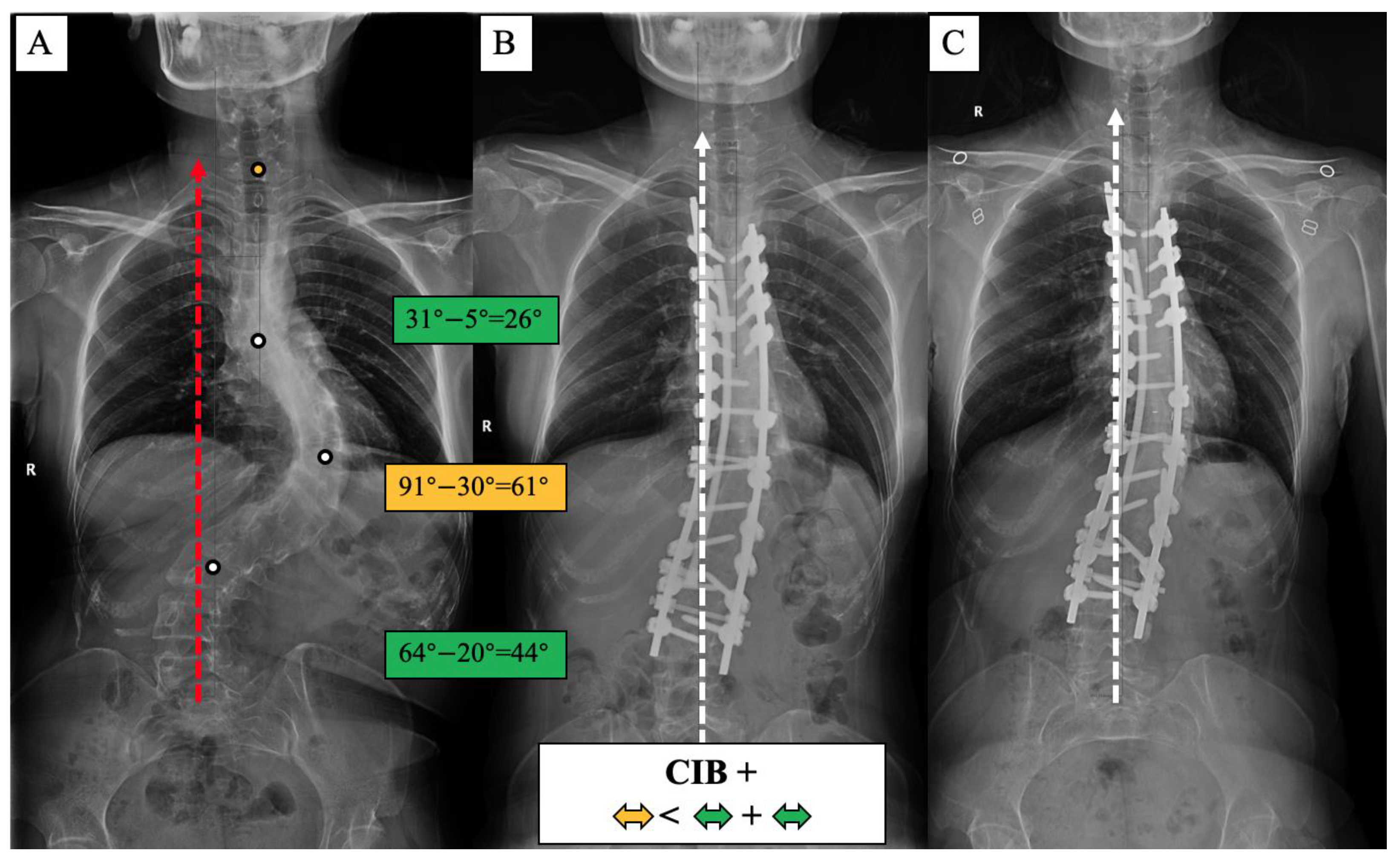 Jpm 13 00897 g008 Jpm 13 00897 g008