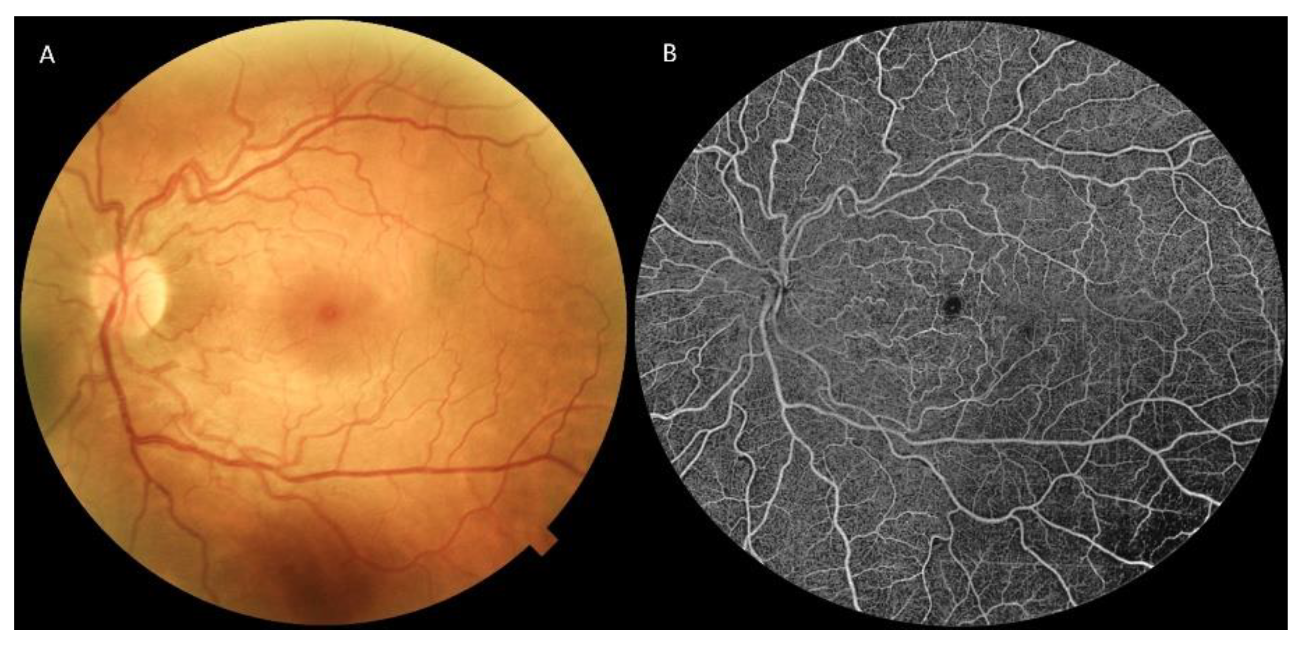 Jpm 13 00904 g003 Jpm 13 00904 g003