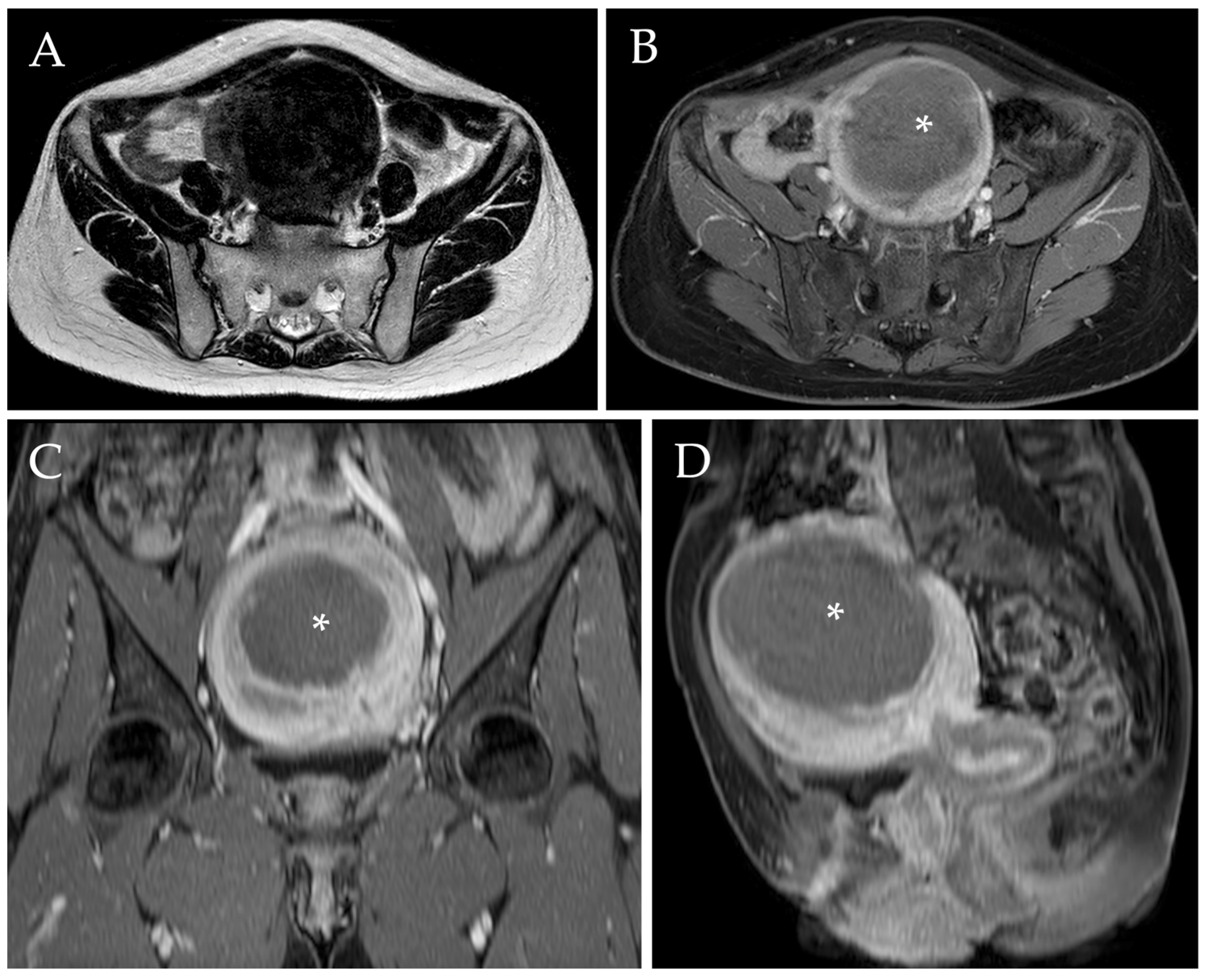 Jpm 13 00906 g004 Jpm 13 00906 g004