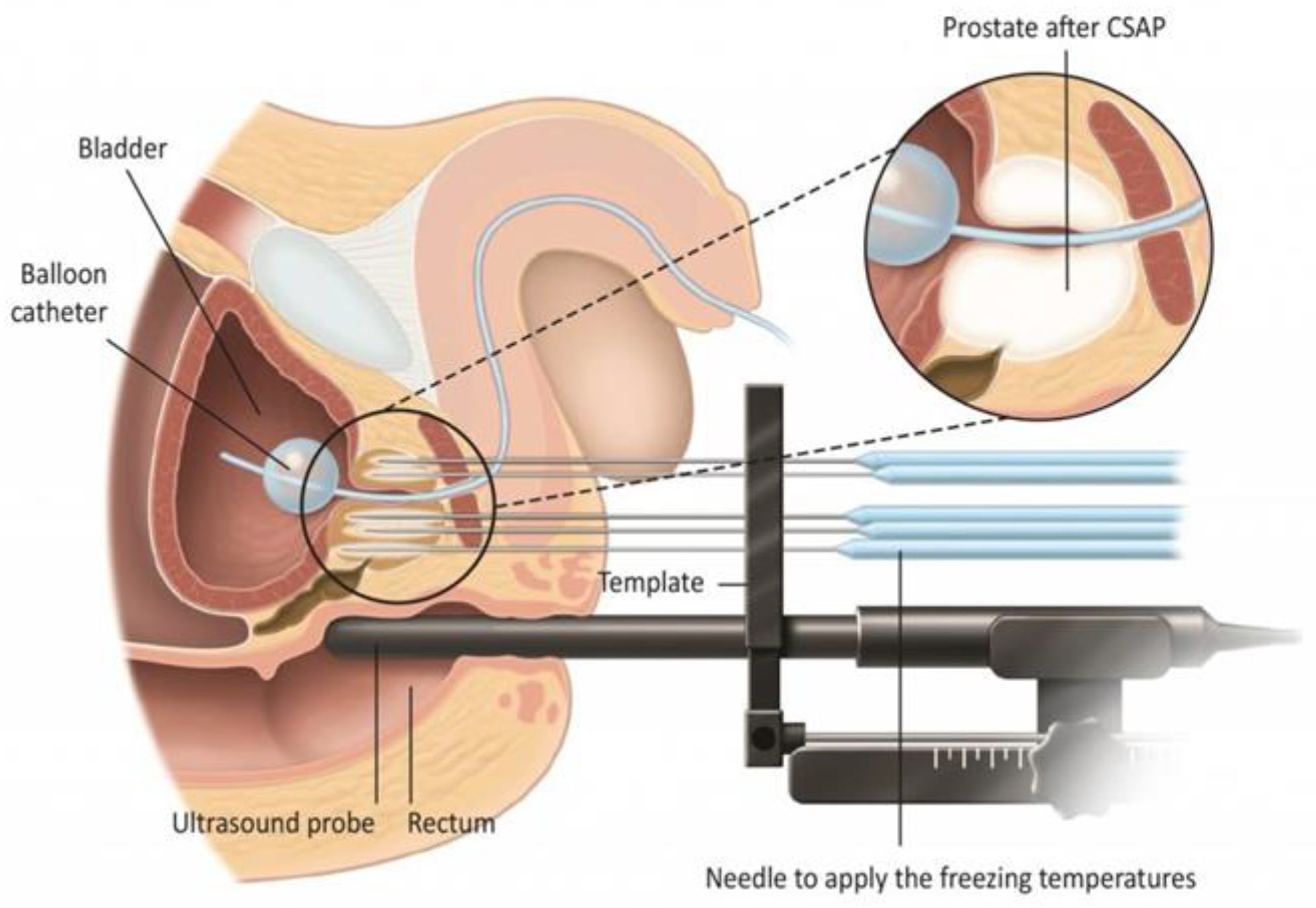 Jpm 13 00978 g005 Jpm 13 00978 g005