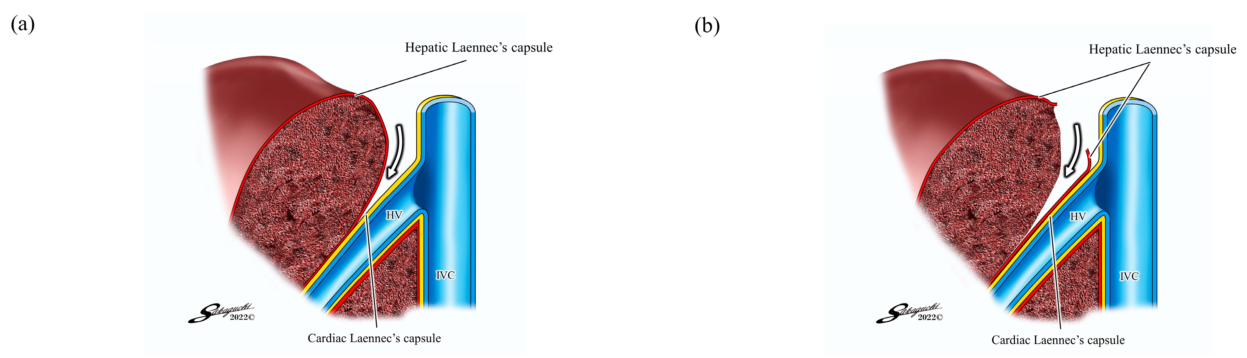 Jpm 13 01007 g002 Jpm 13 01007 g002