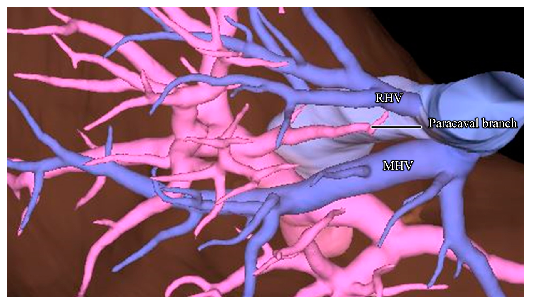 Jpm 13 01007 g003 Jpm 13 01007 g003