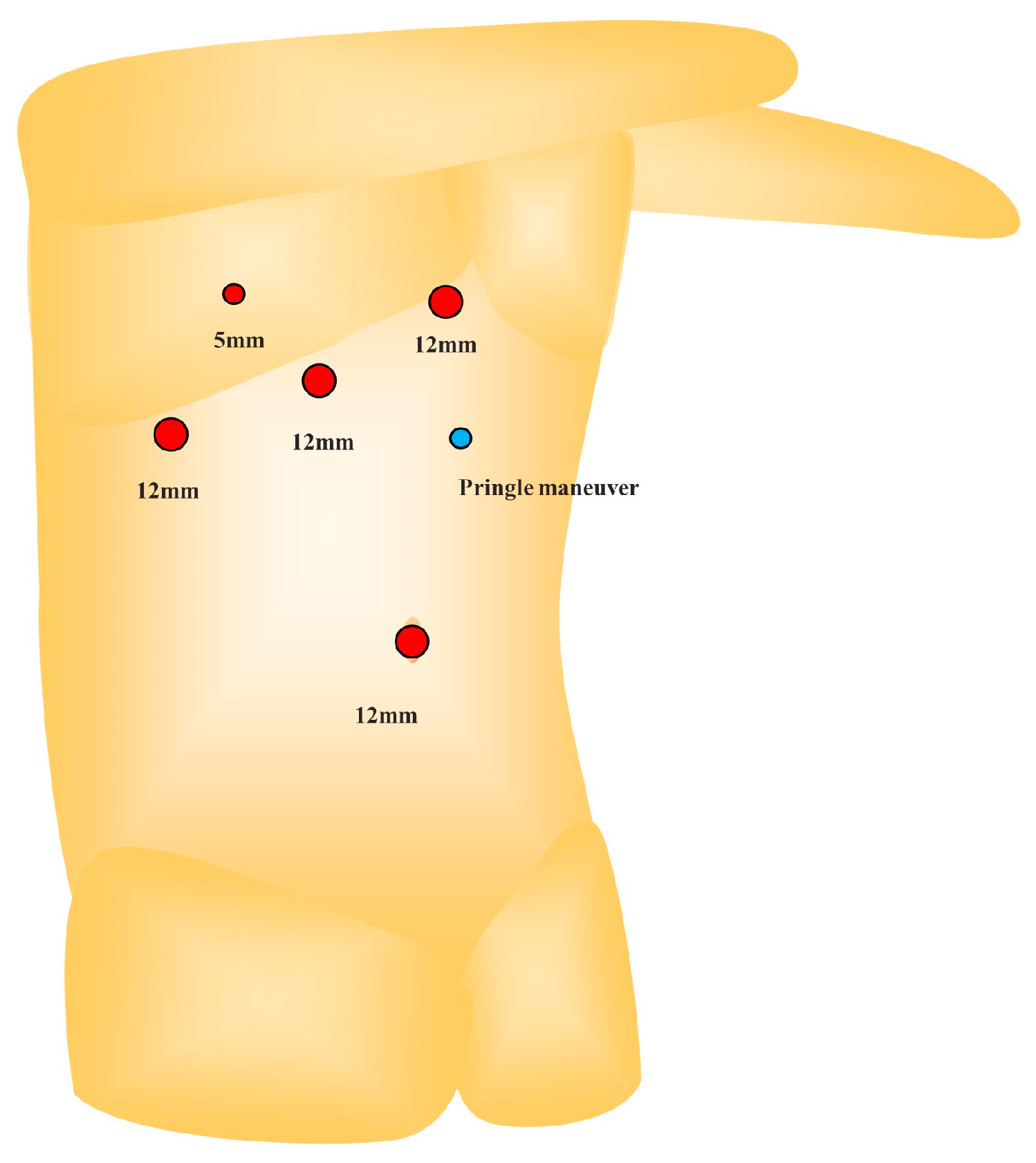 Jpm 13 01007 g005 Jpm 13 01007 g005