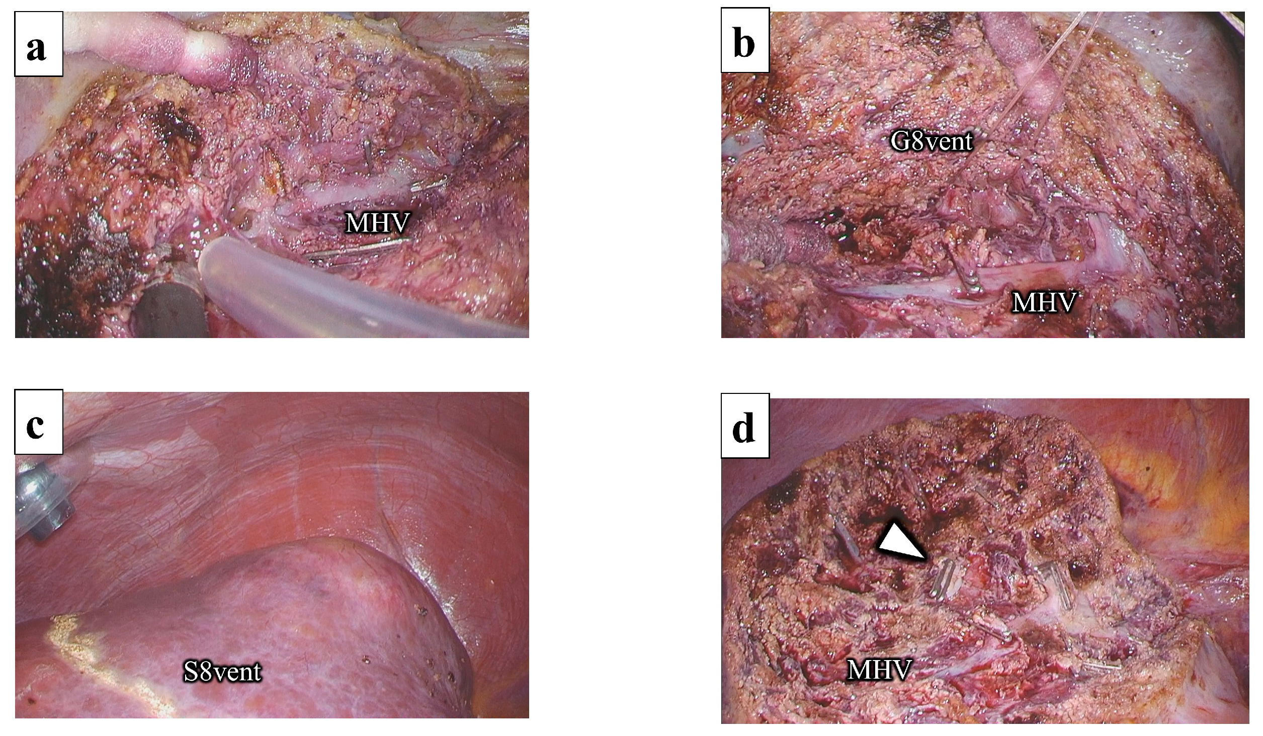 Jpm 13 01007 g006 Jpm 13 01007 g006