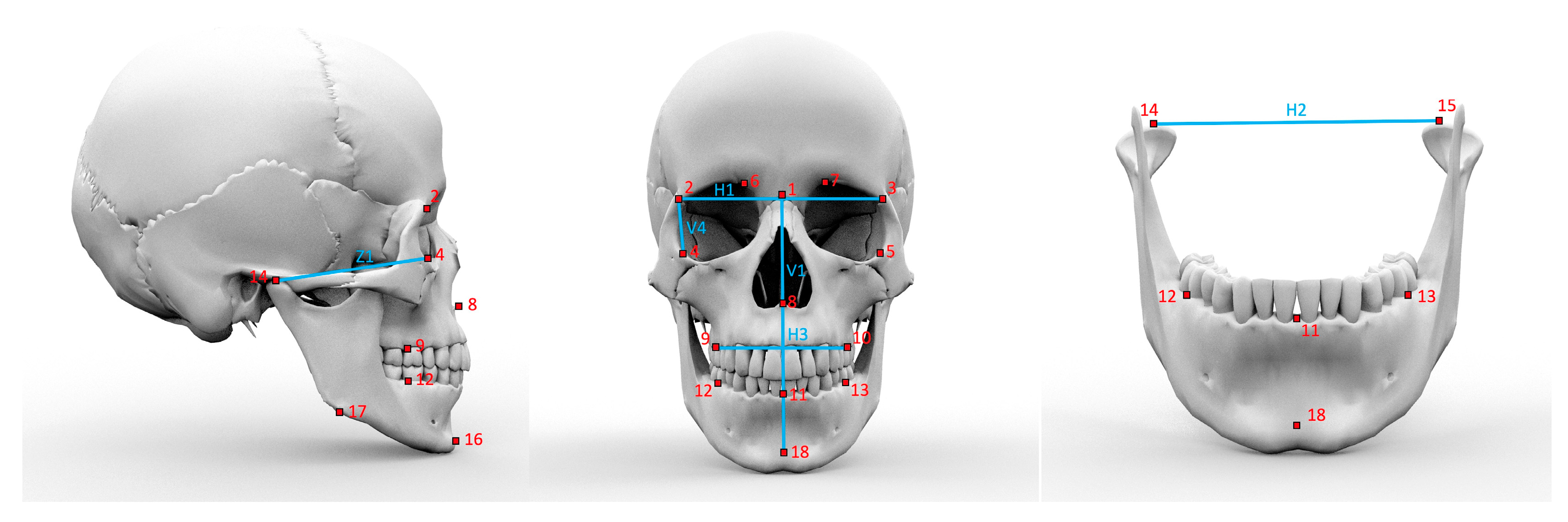 JPM Free FullText Cross Sectional Analysis of Eurasian Skull