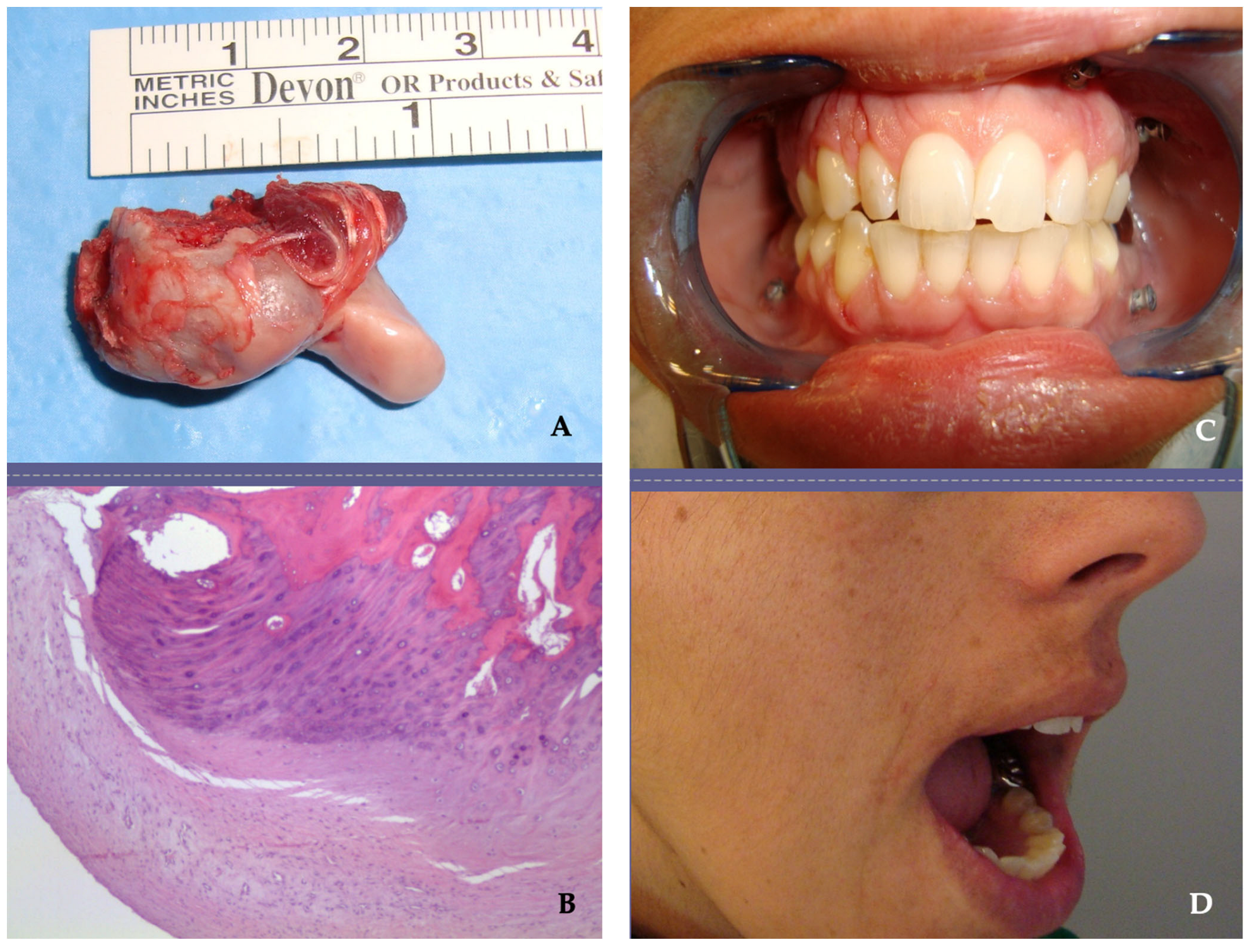 Jpm 13 01021 g002 Jpm 13 01021 g002