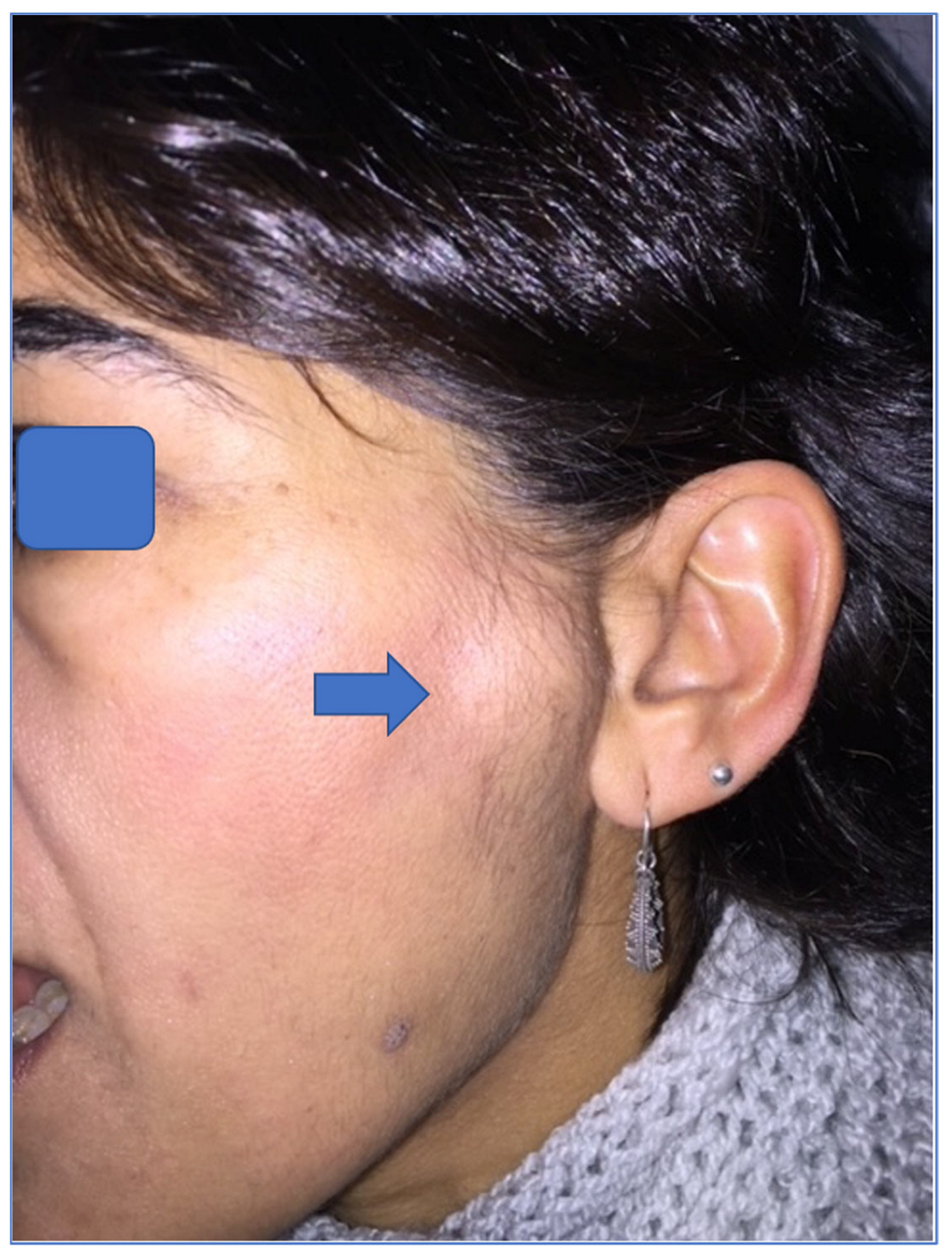 Jpm 13 01021 g003 Jpm 13 01021 g003