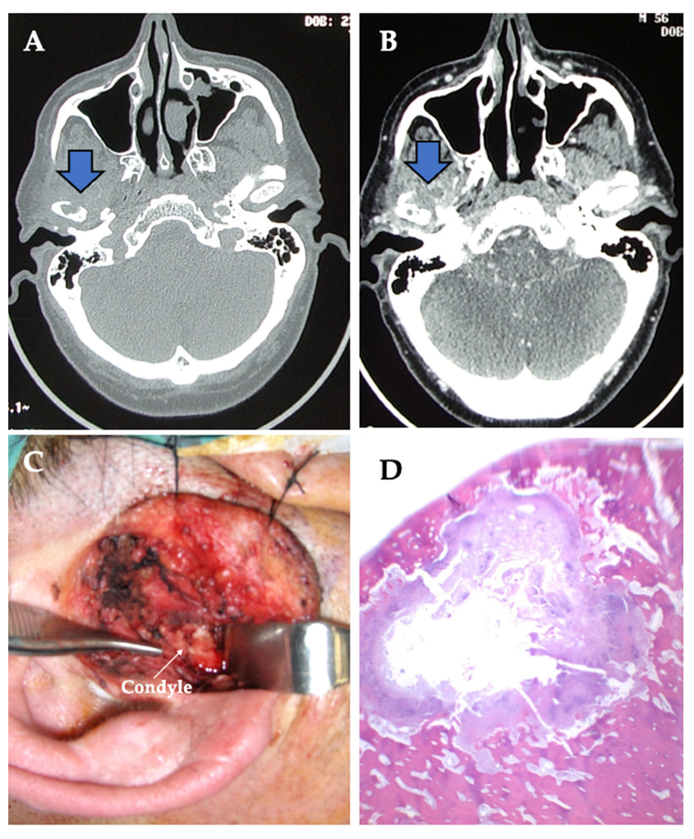 Jpm 13 01021 g004 Jpm 13 01021 g004