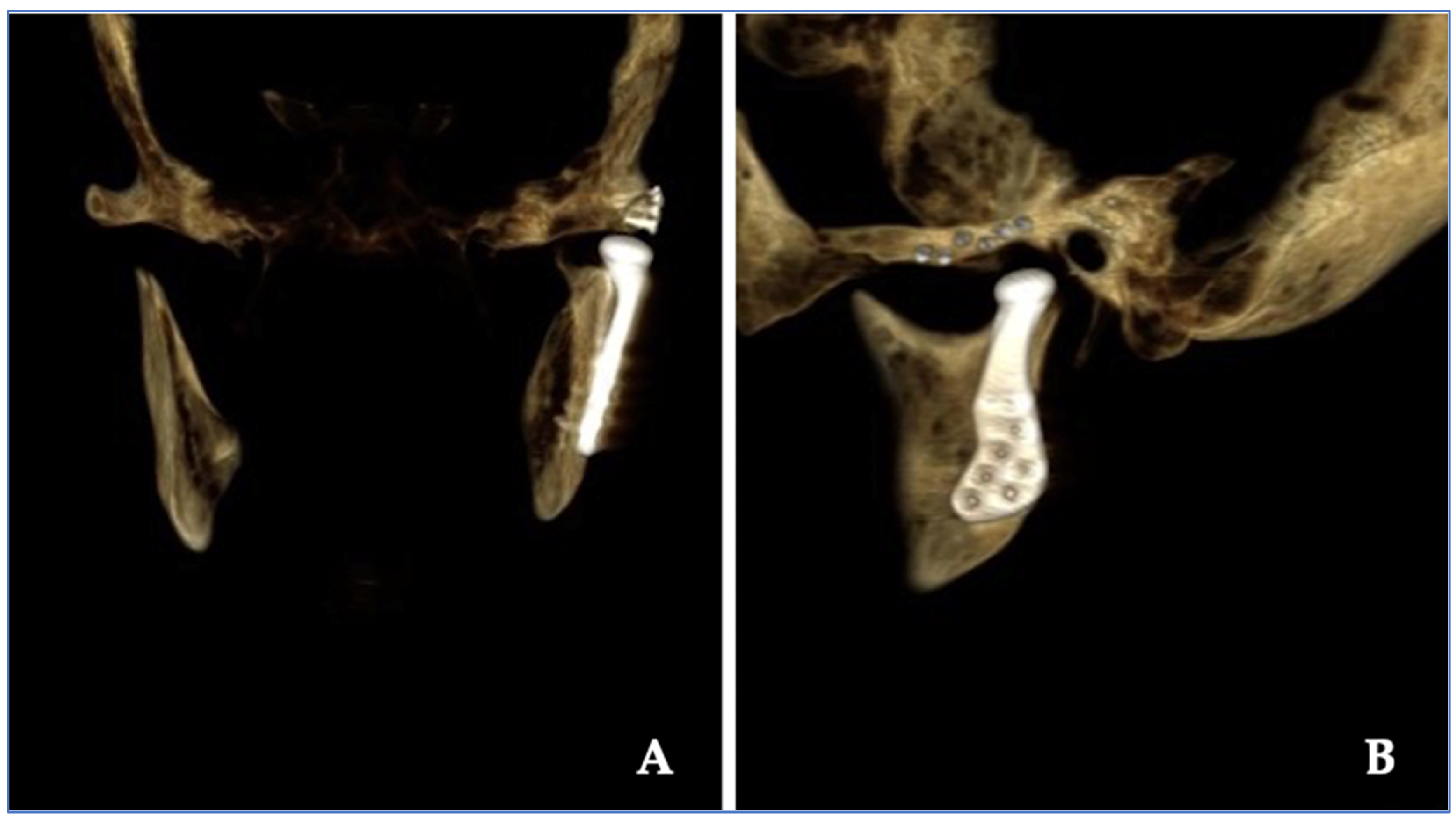 Jpm 13 01021 g005 Jpm 13 01021 g005