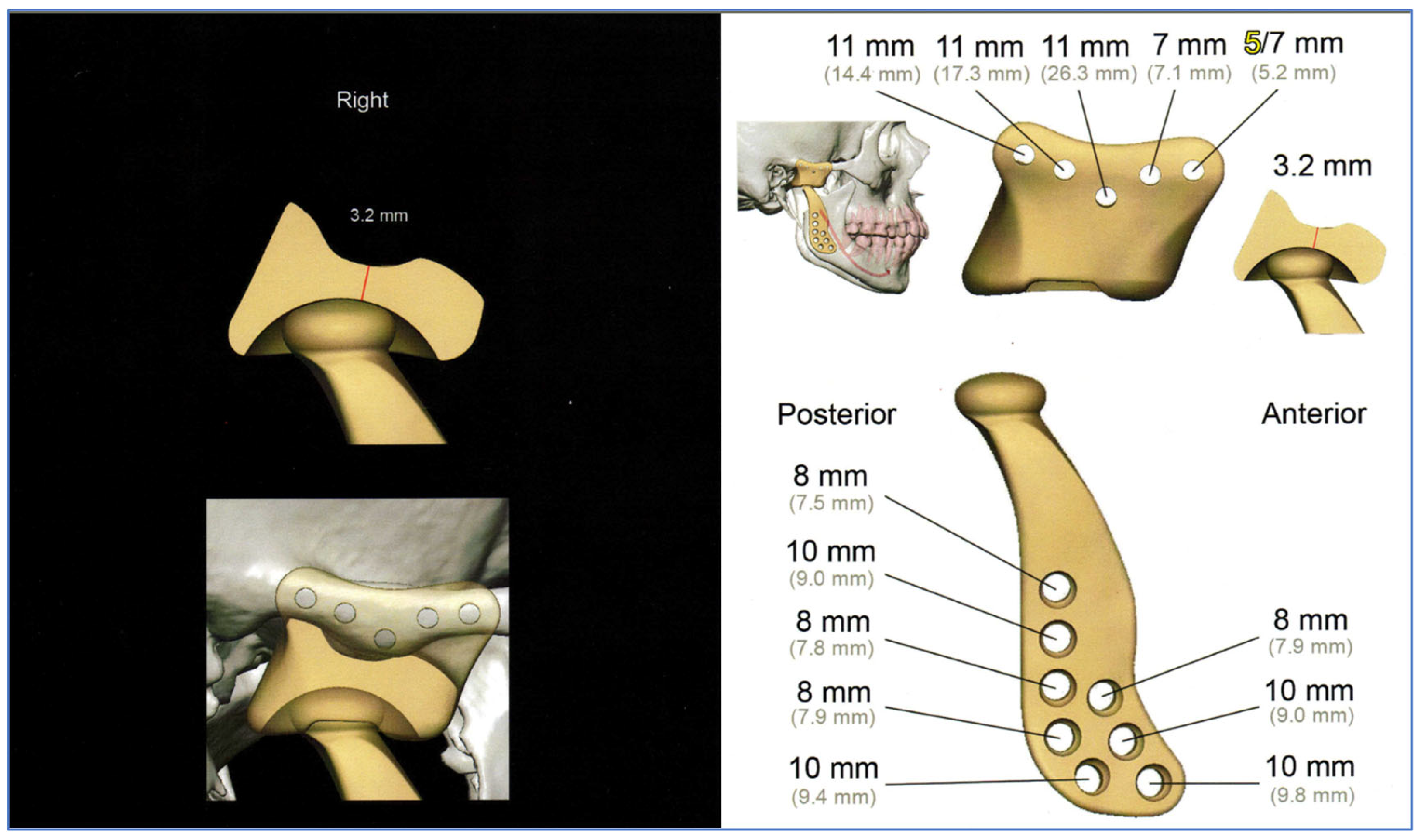 Jpm 13 01021 g006 Jpm 13 01021 g006