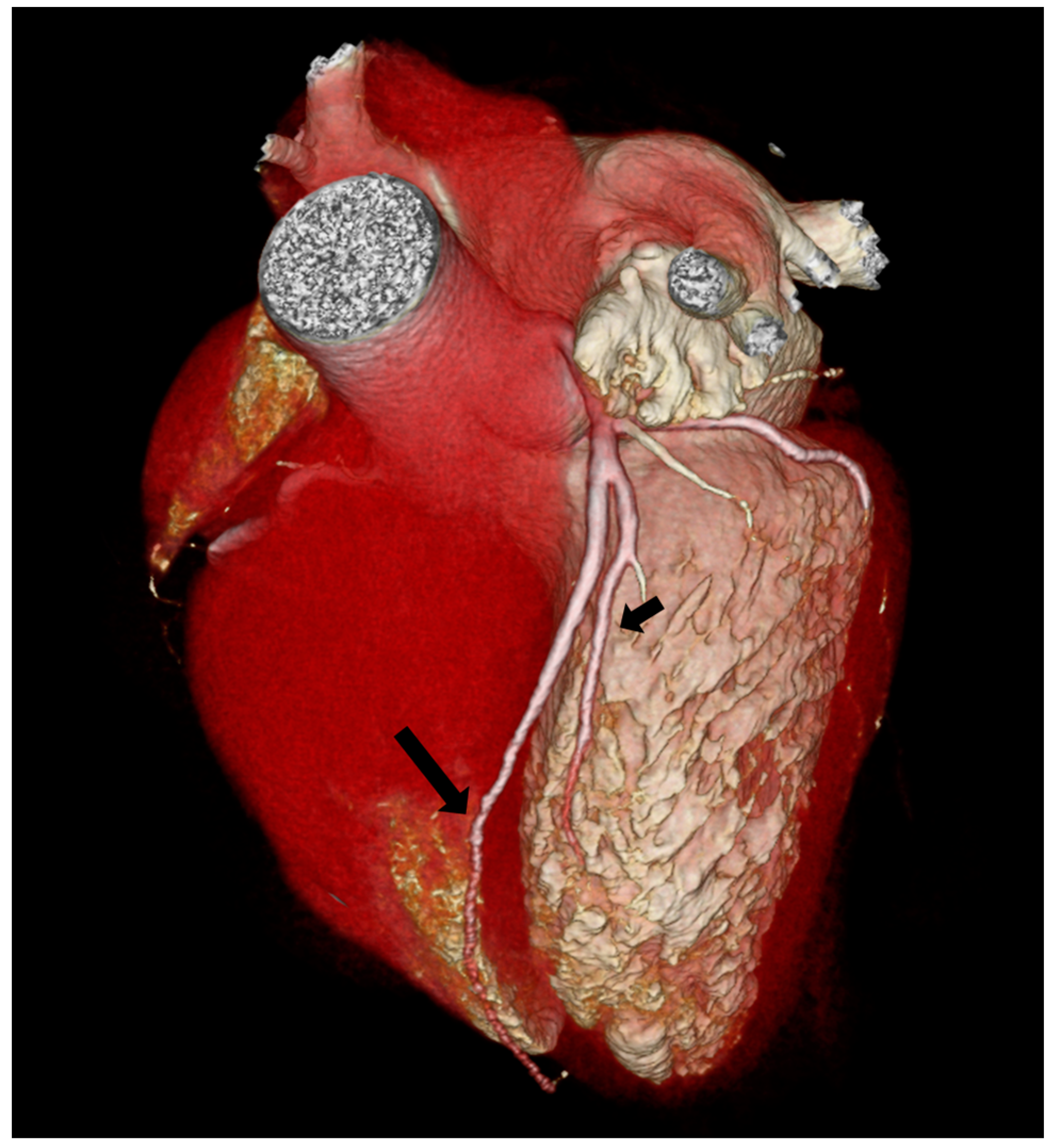 Jpm 13 01127 g004 Jpm 13 01127 g004