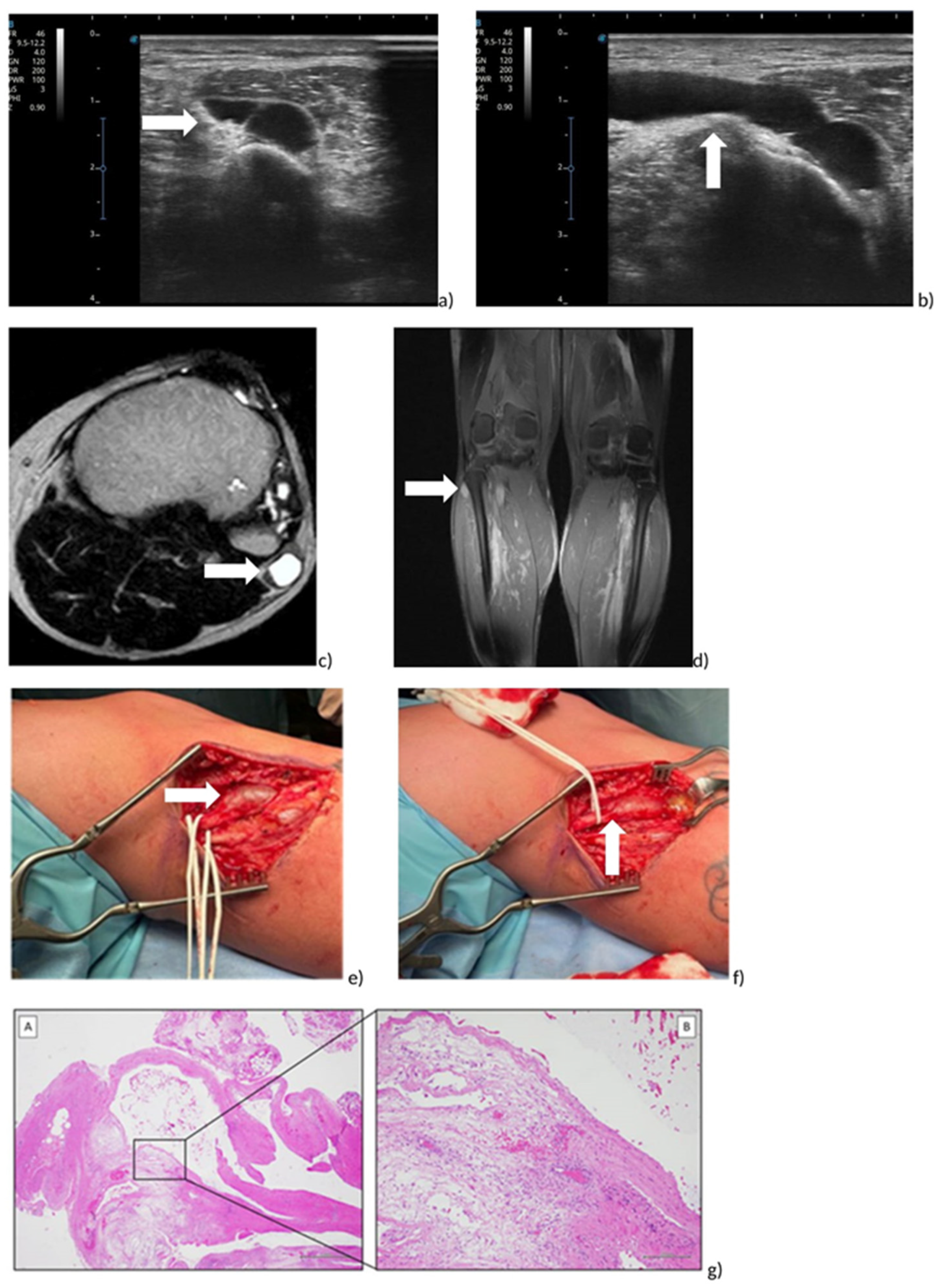 Jpm 13 01137 g003 Jpm 13 01137 g003