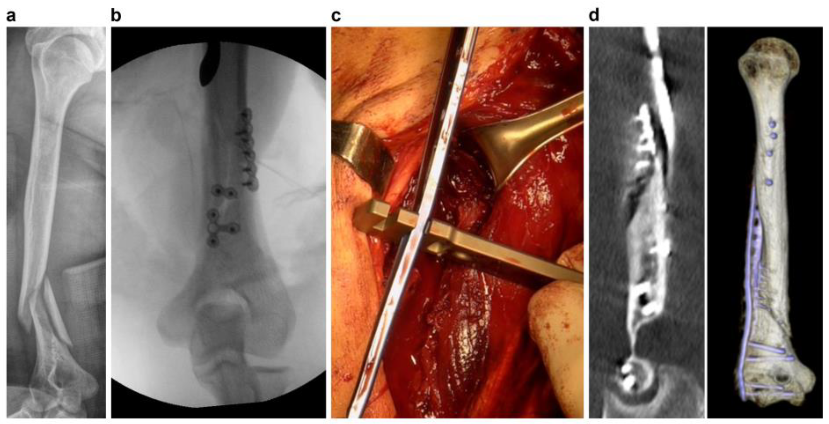 Jpm 13 01145 g003 Jpm 13 01145 g003